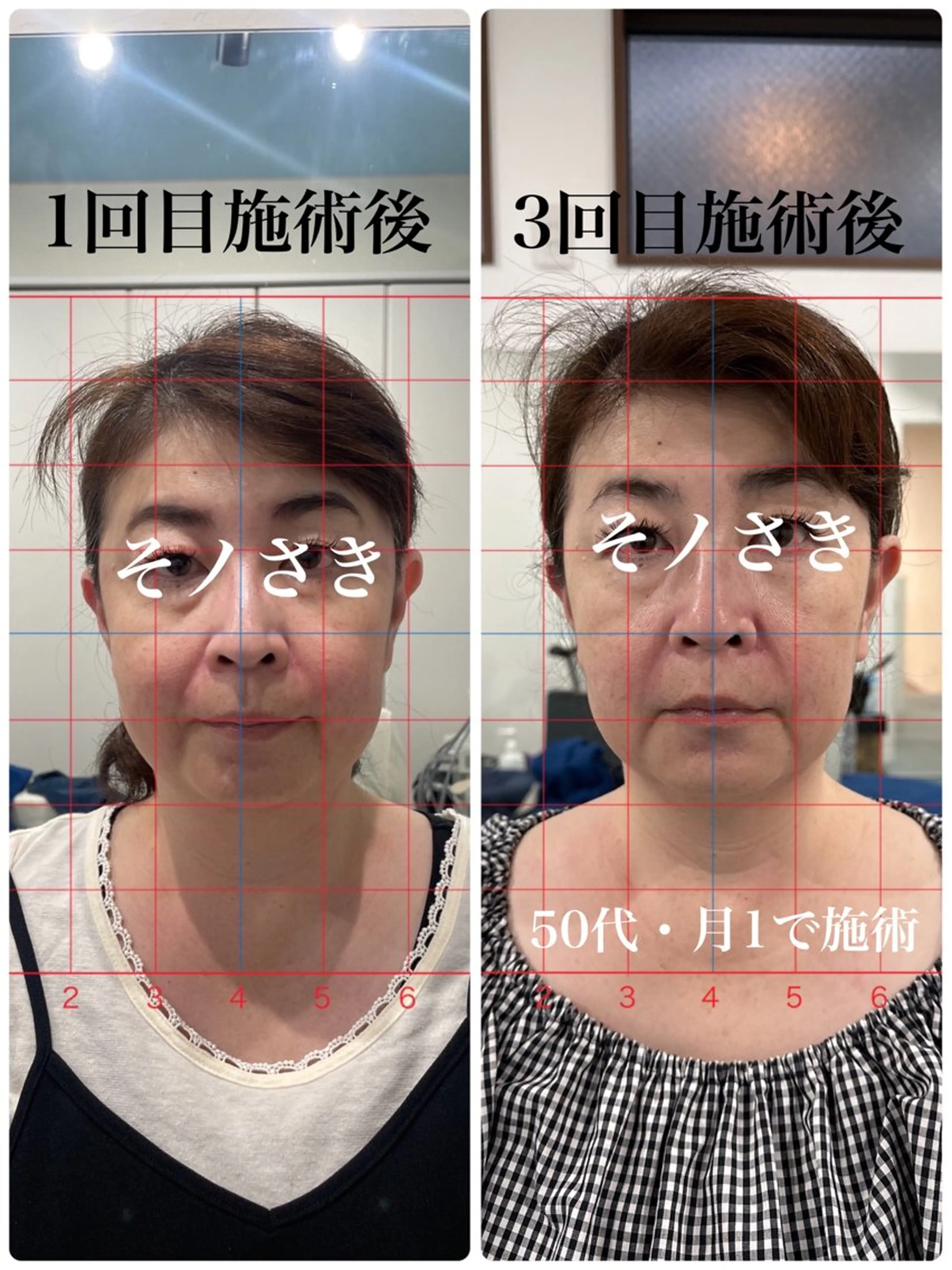 そノさき所属・大阪のシーサー🦁 島袋のエステ・リラクイメージ