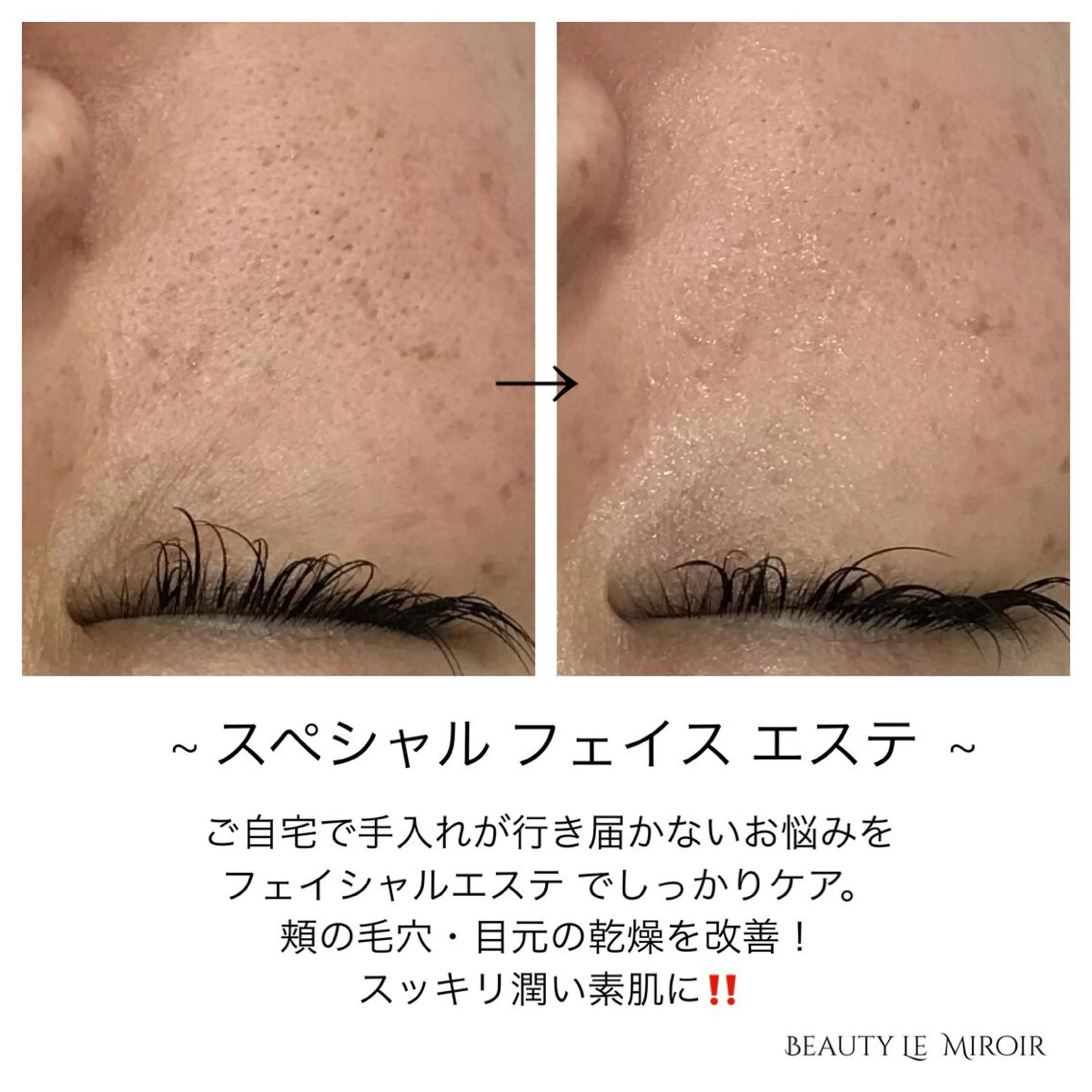 ビューティー ミロワールのエステ・リラクイメージ