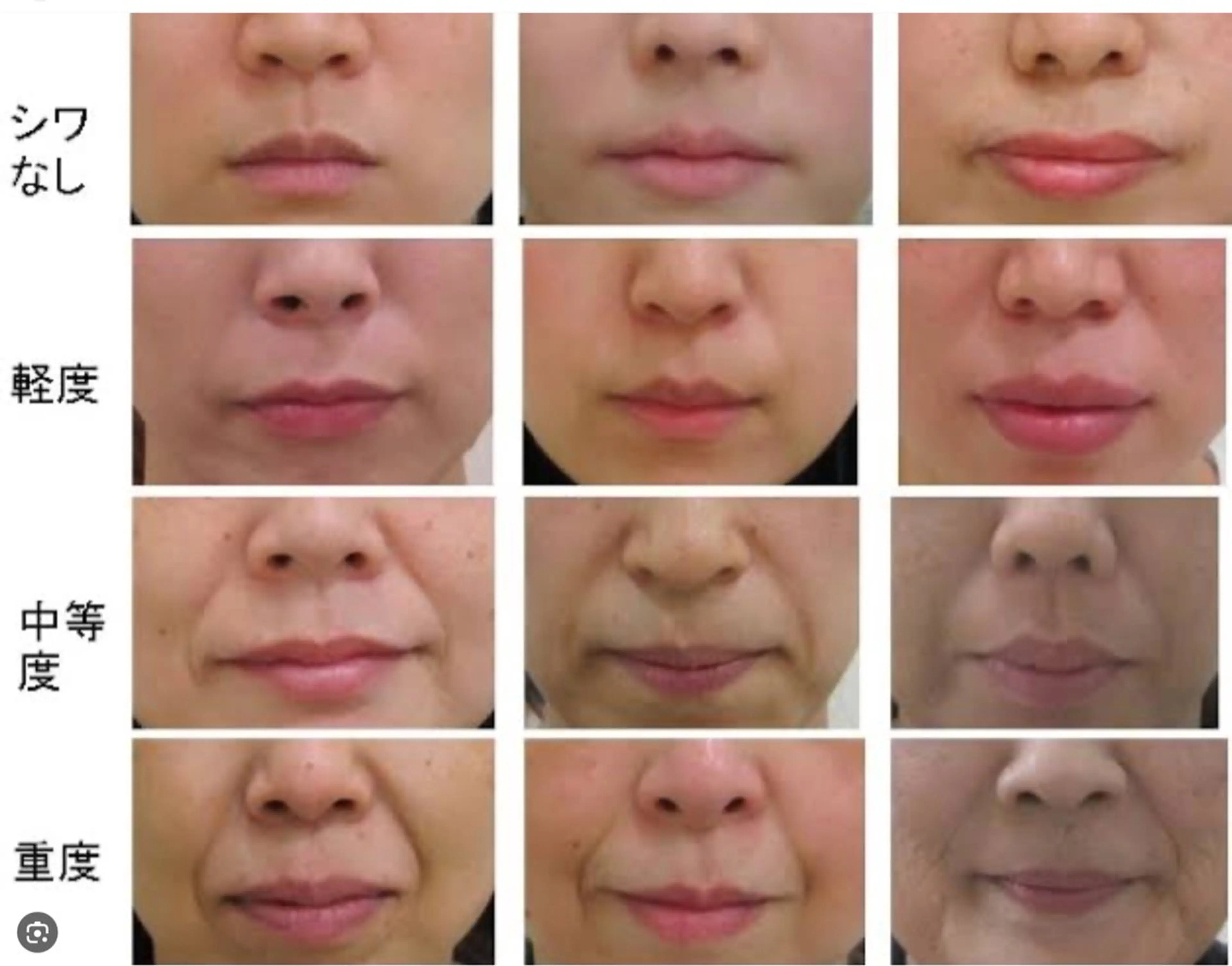 エステ リラク ☺ハーブピール💕 ソフィアカロン💖のエステ・リラクイメージ