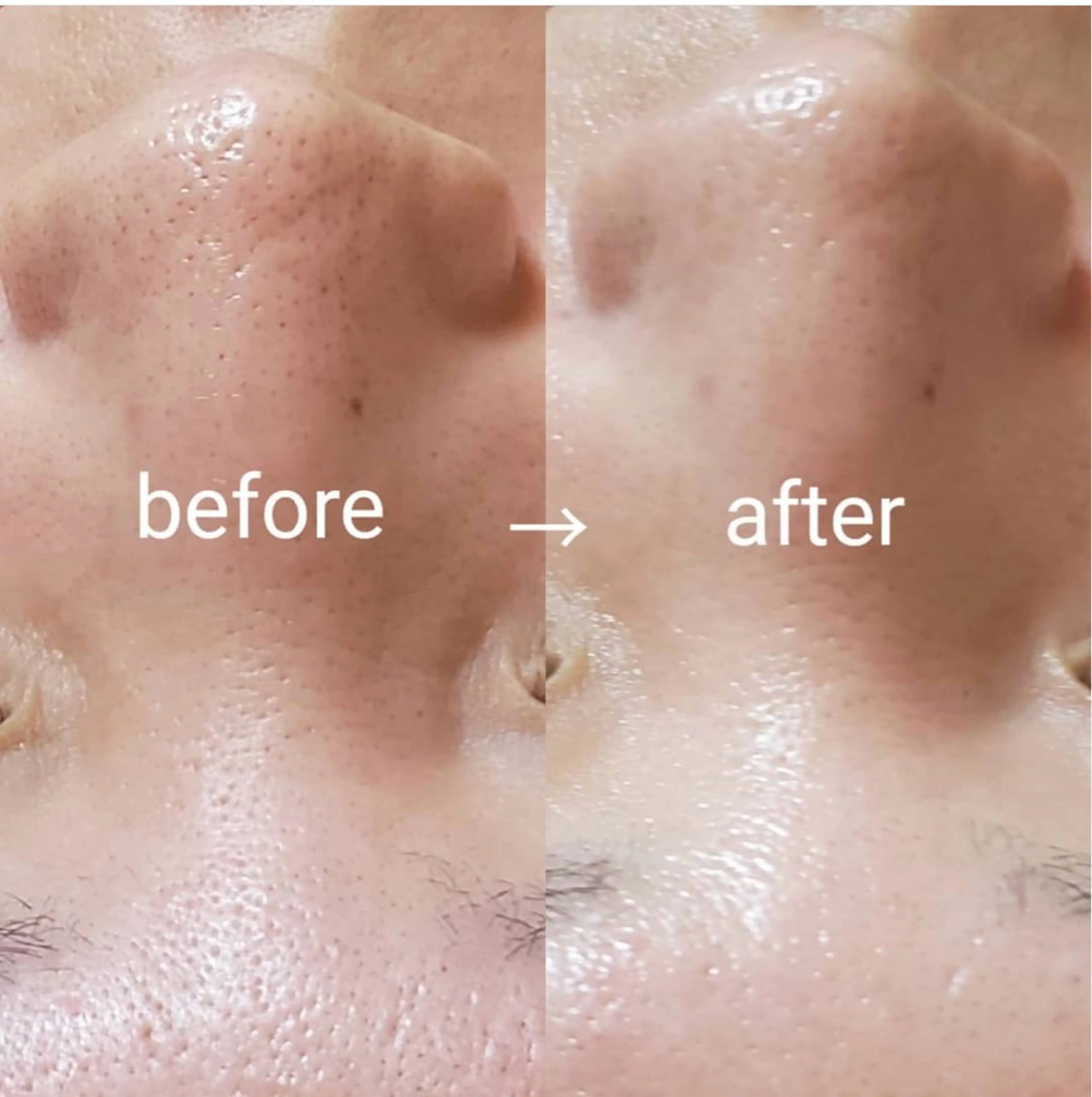 Luce所属・Luce Shokoのエステ・リラクイメージ