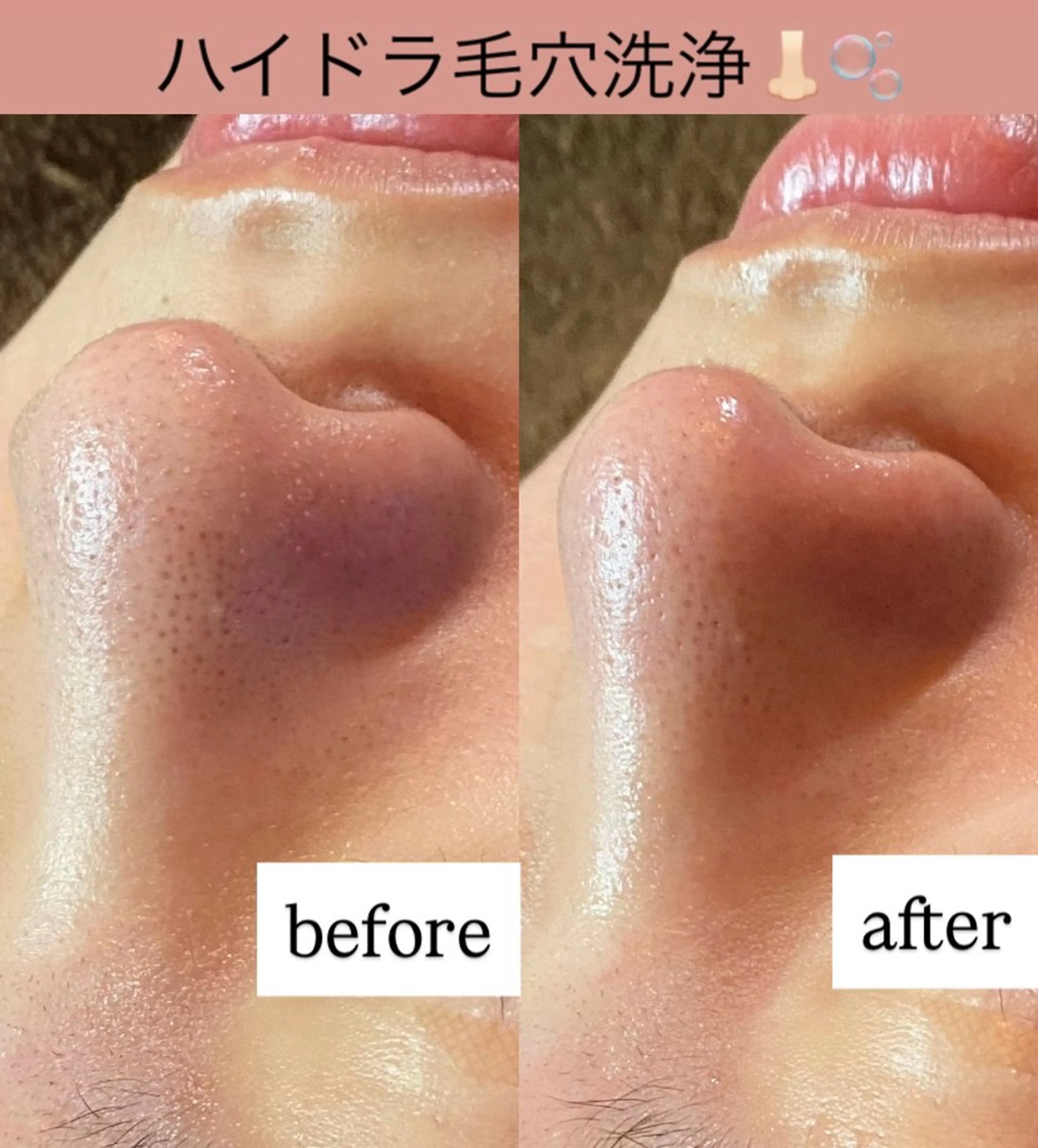 エステ 肌質改善専門 ハーブ /毛穴洗浄 リエイトのエステ・リラクイメージ