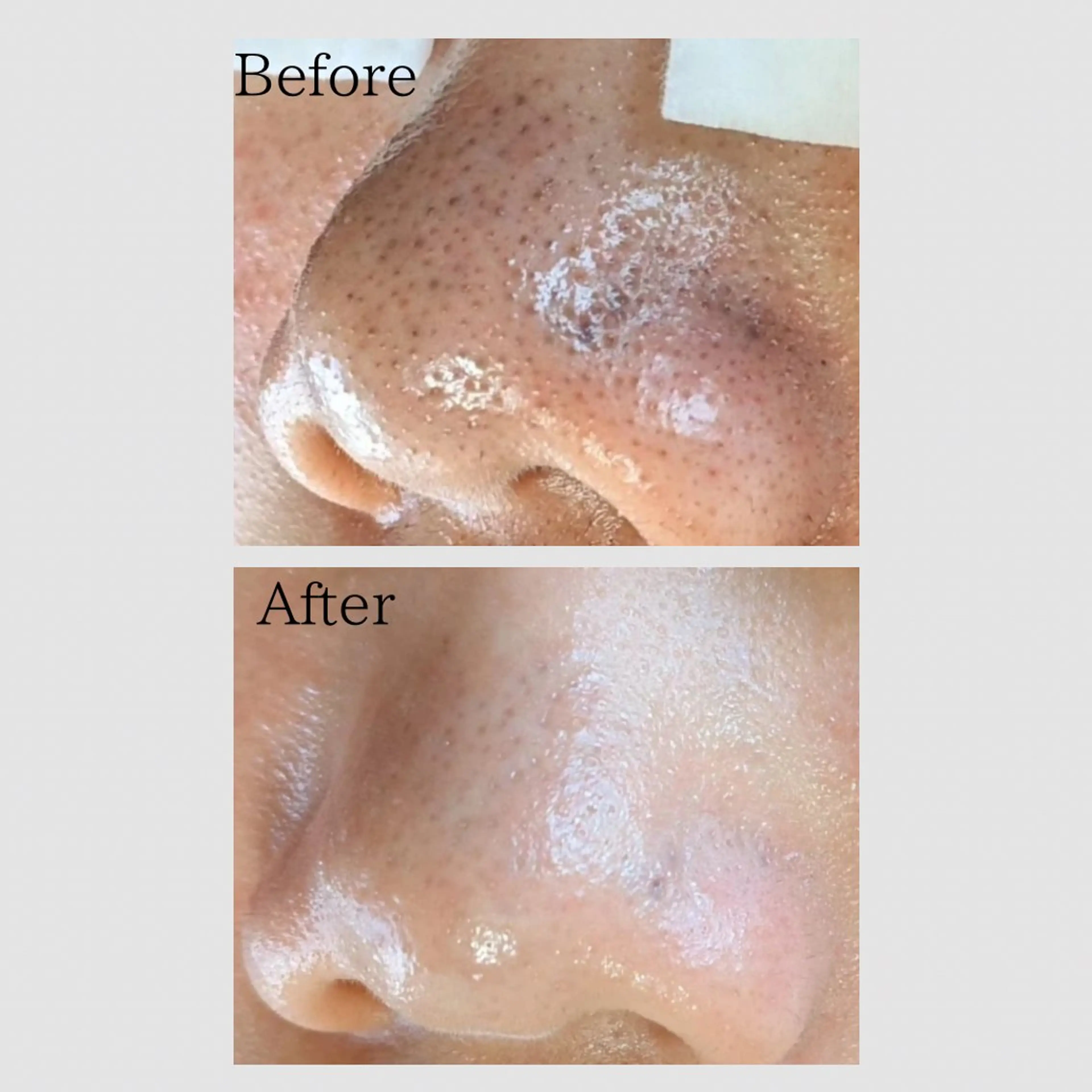 エステ リラク 韓国肌管理 【毛穴専科】のエステ・リラクイメージ