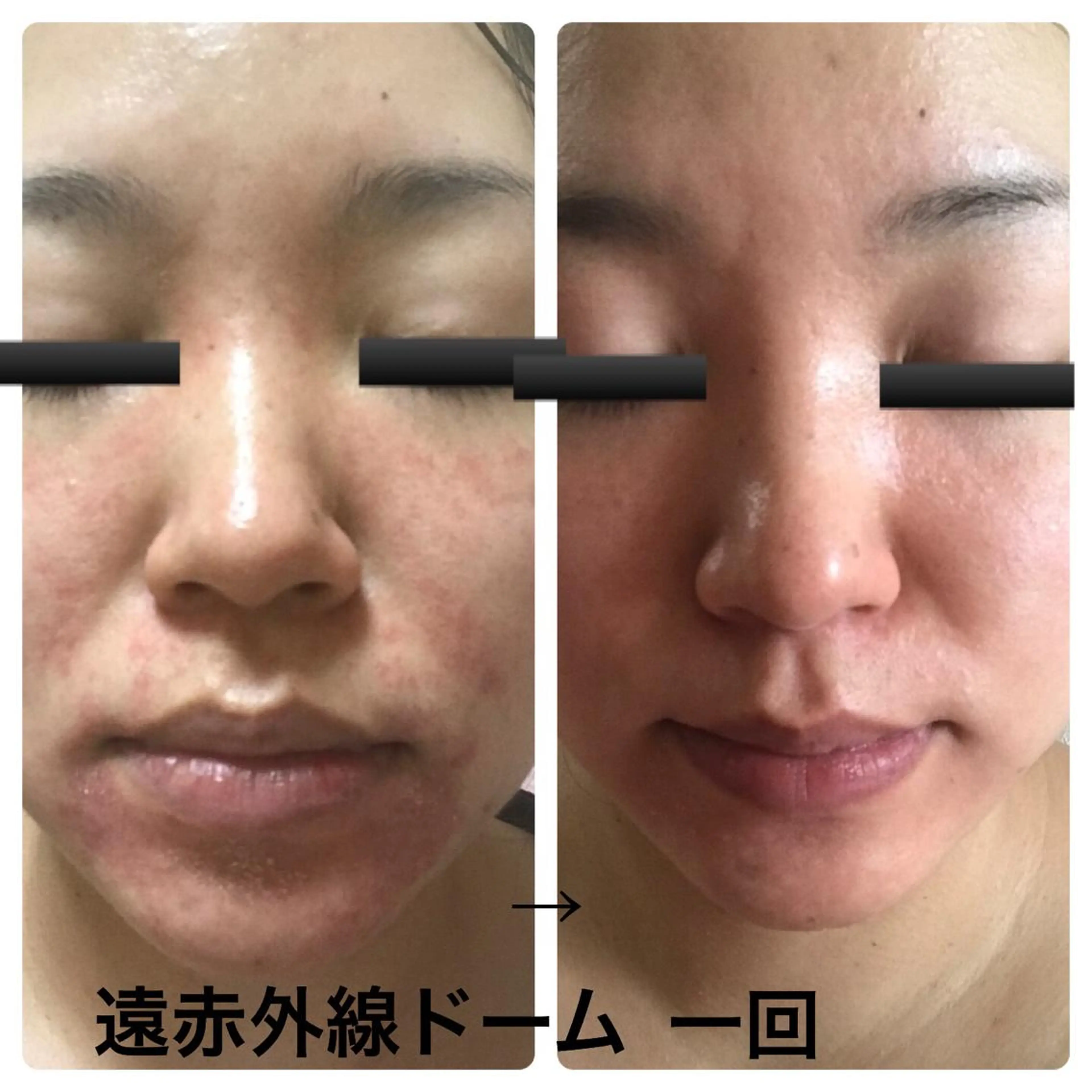 フェアリーローズ所属・fairyrose organicエステのエステ・リラクイメージ