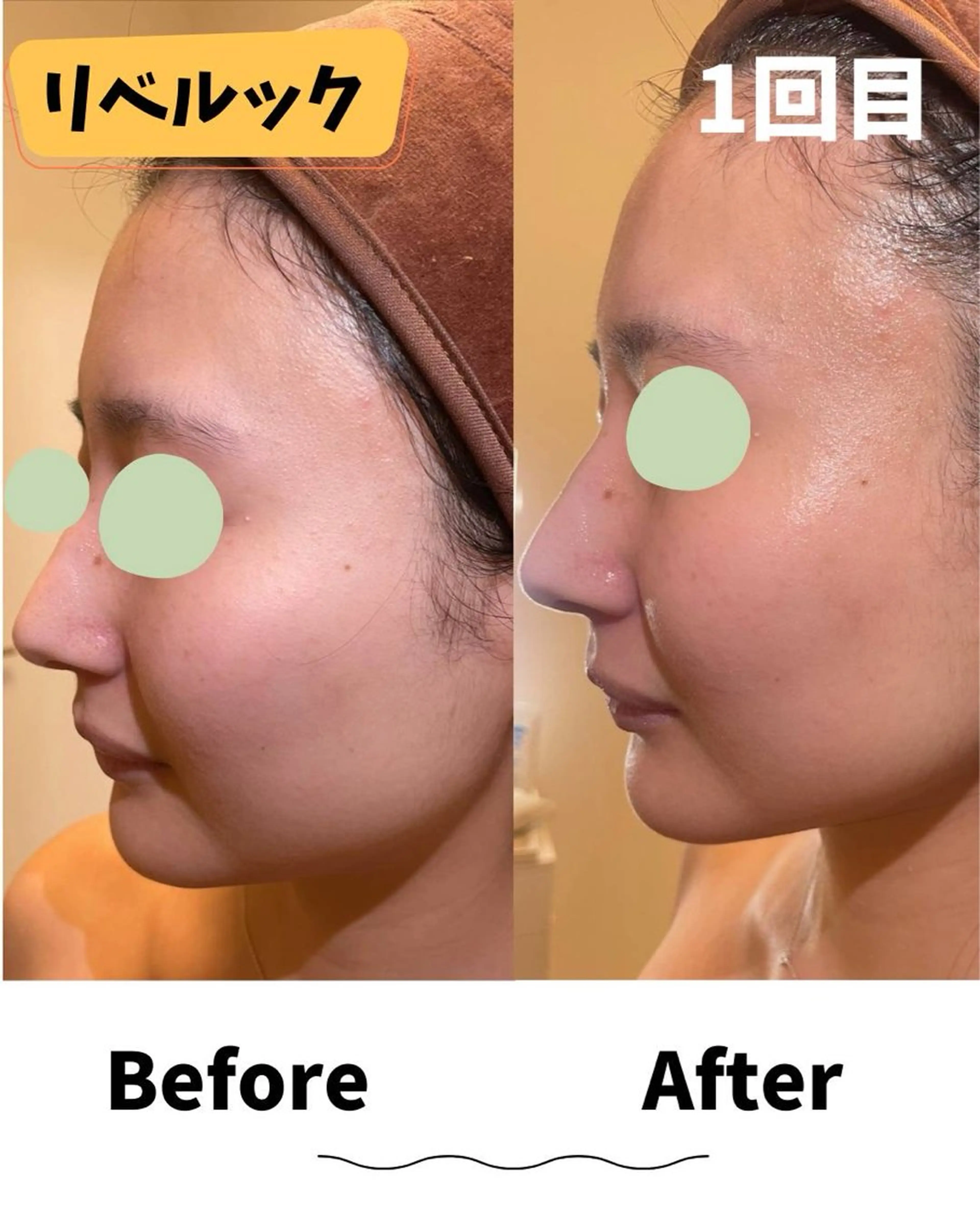 エステ コンセプトサロン〜友〜所属・コンセプトサロン友 木下のエステ・リラクイメージ