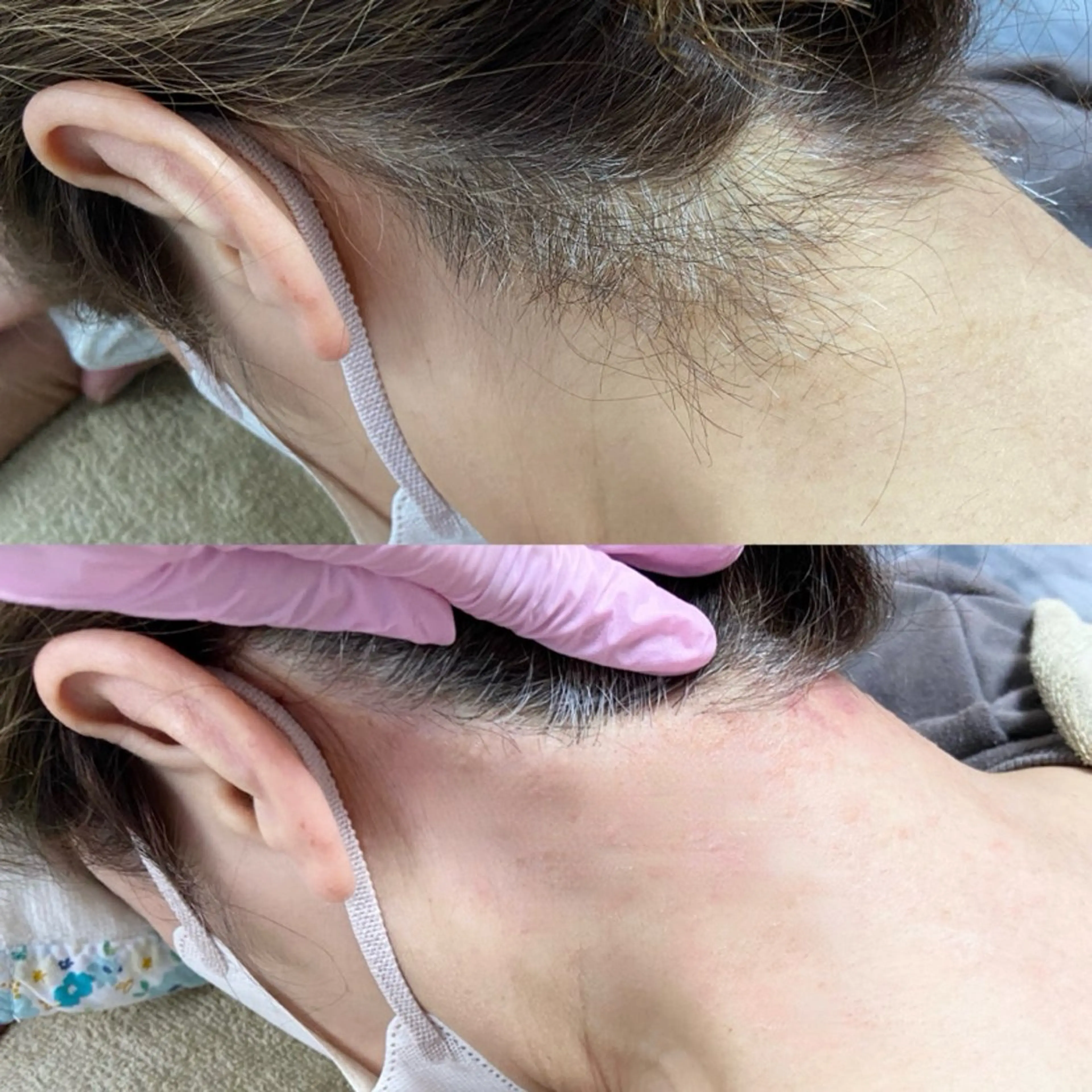 脱毛 &me ayakaのエステ・リラクイメージ