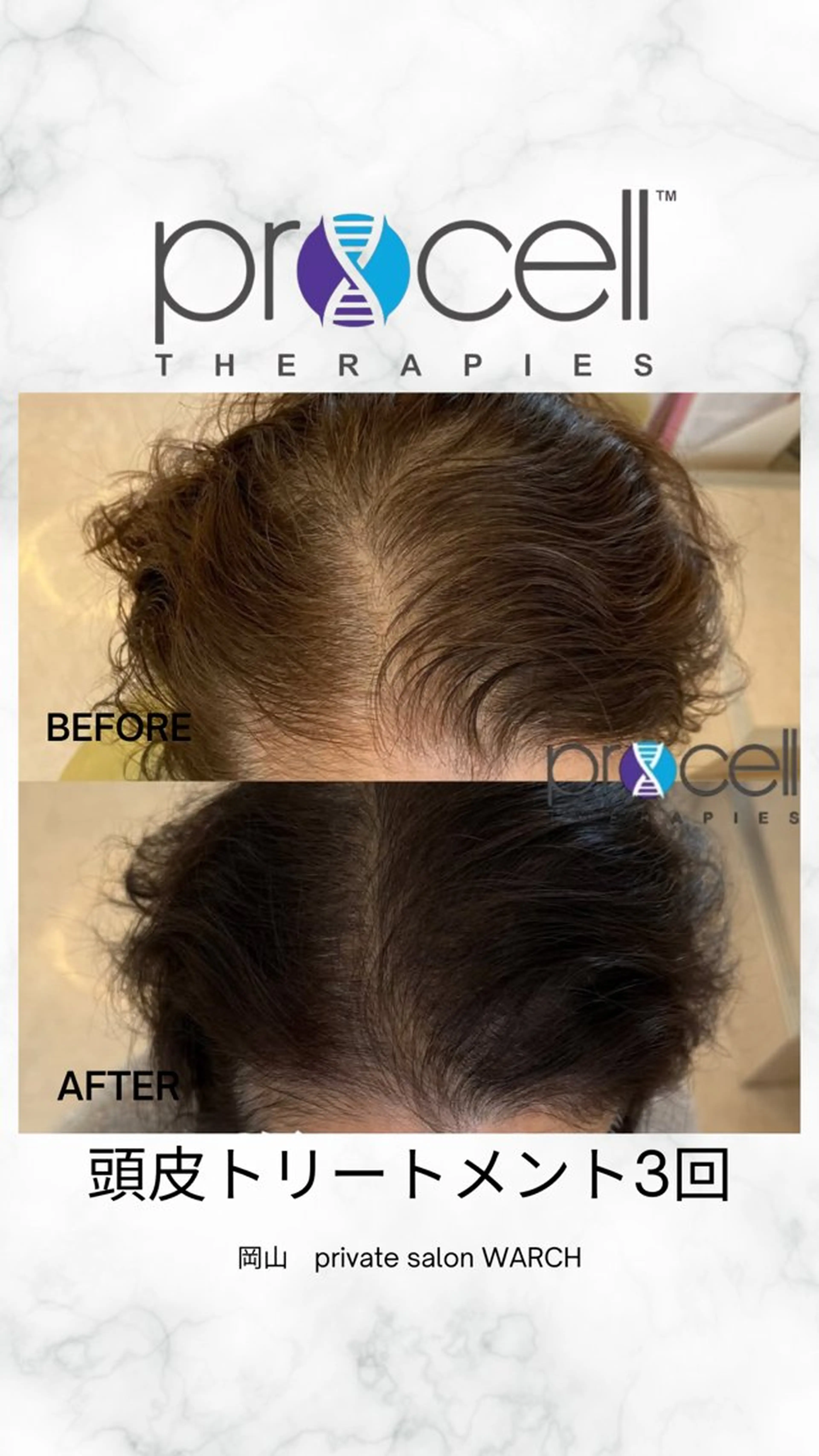 WARCH Marieのその他イメージ