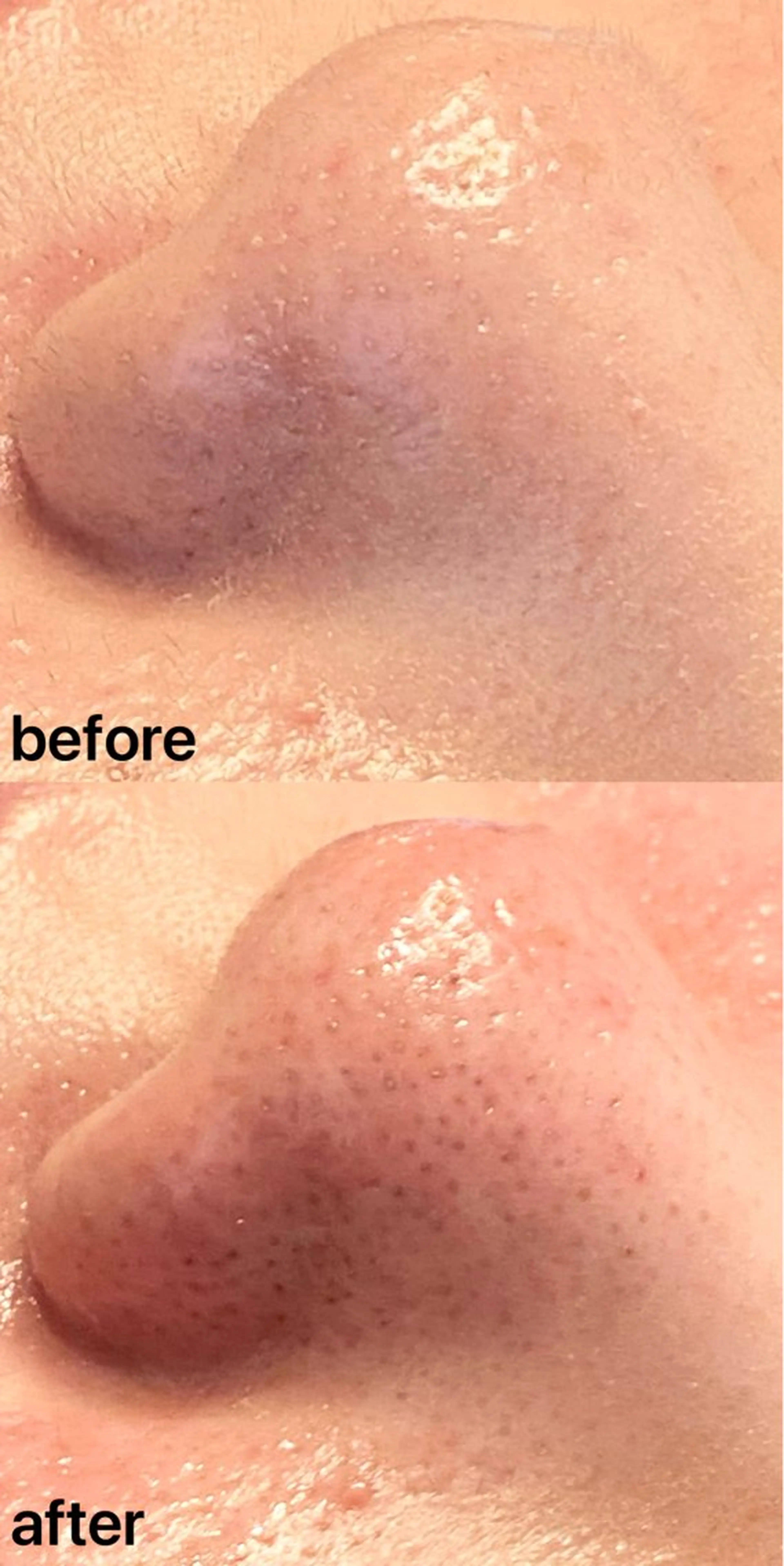 眉毛×小顔矯正サロン パピヨンsakiのエステ・リラクイメージ