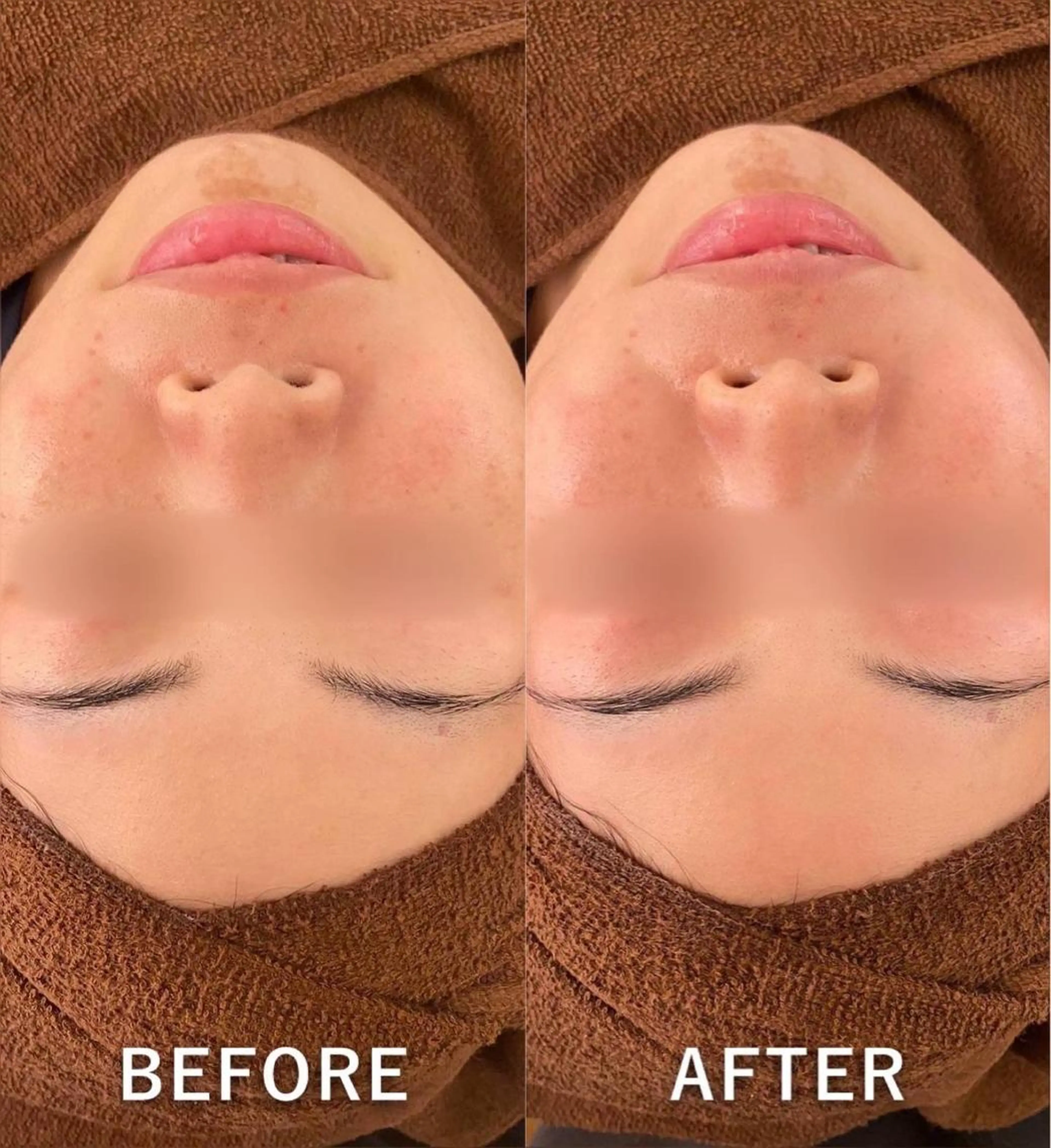 Lien eye salonのエステ・リラクイメージ