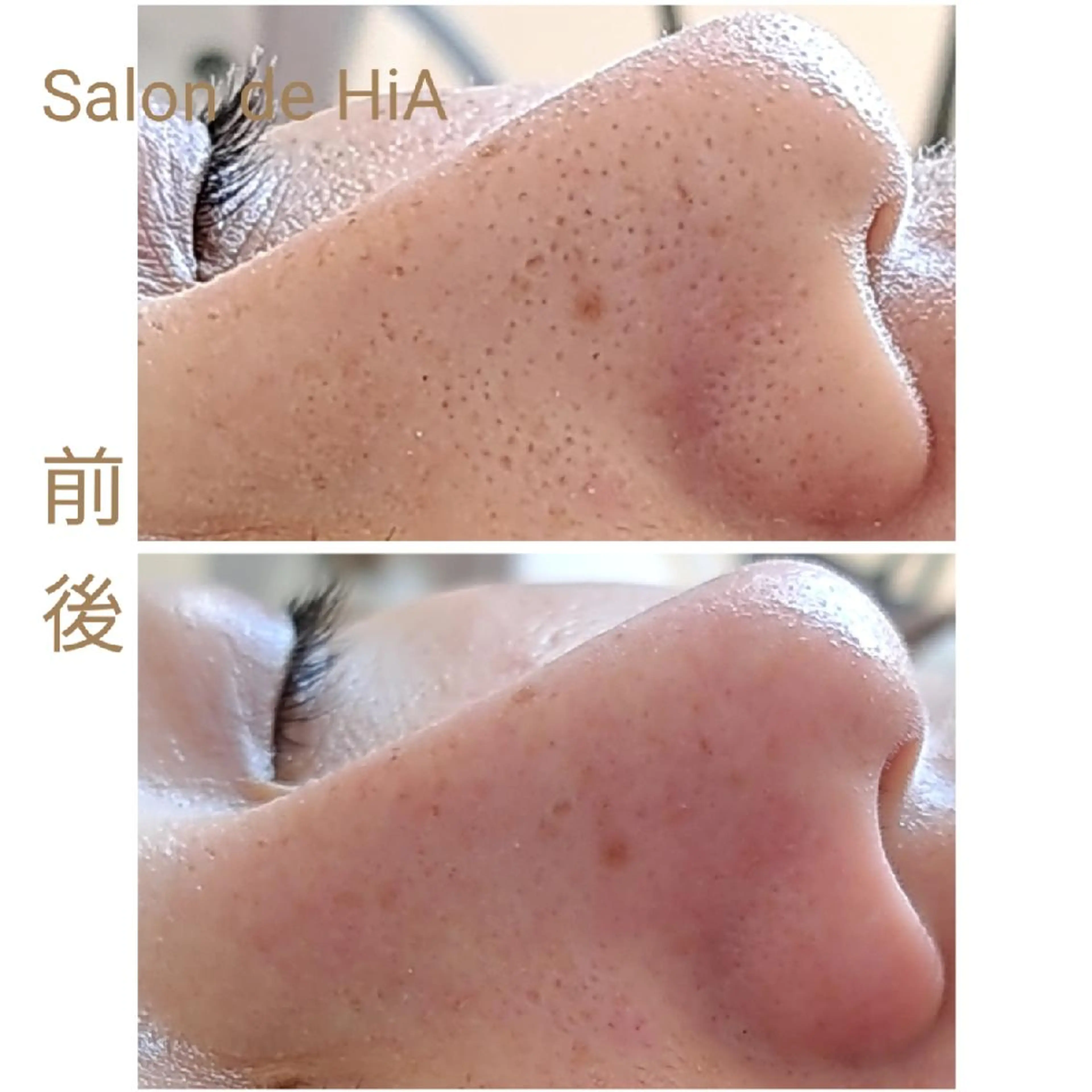 エステ Salon de  HiAのエステ・リラクイメージ