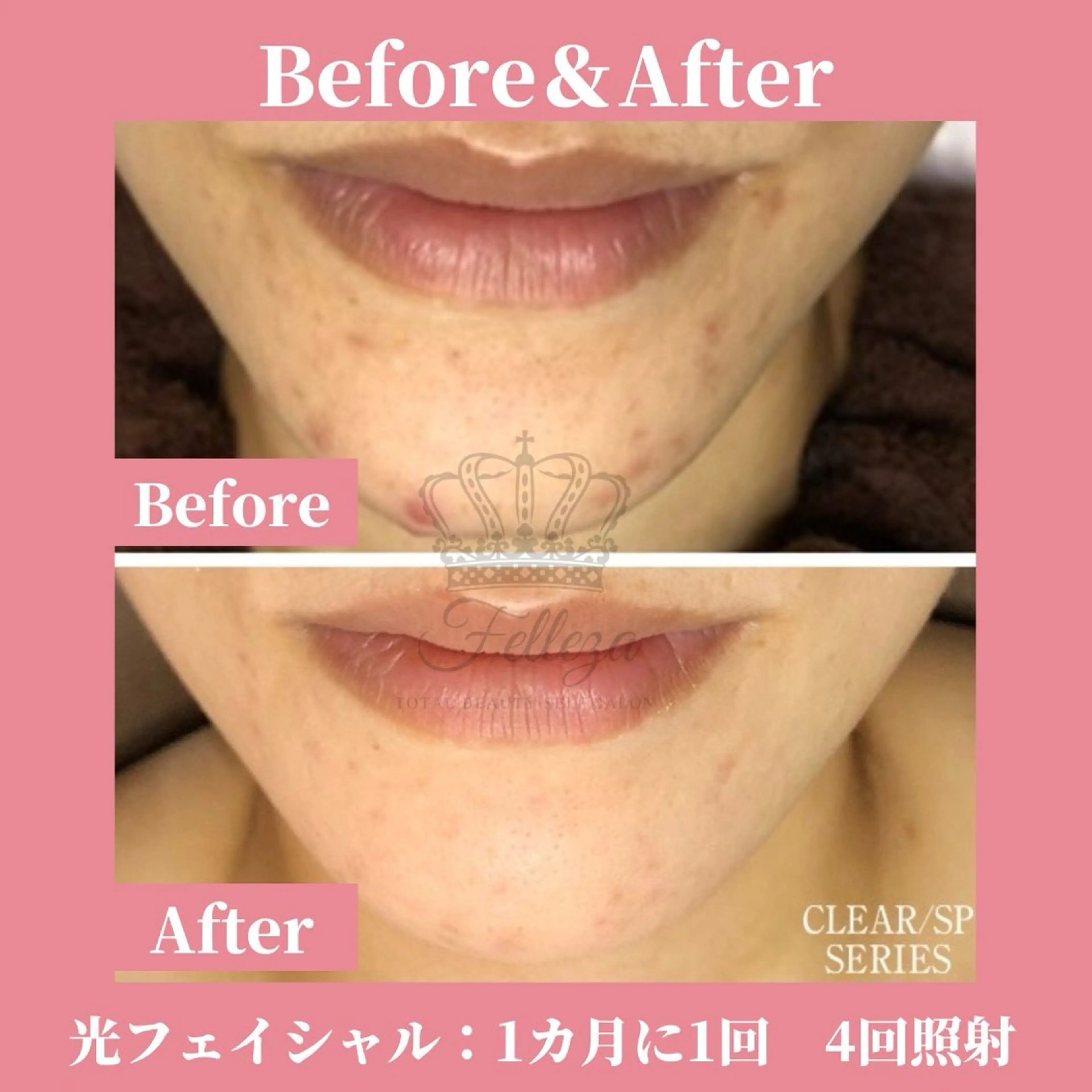 有人型セルフサロン 脱毛/痩身/美顔のその他イメージ