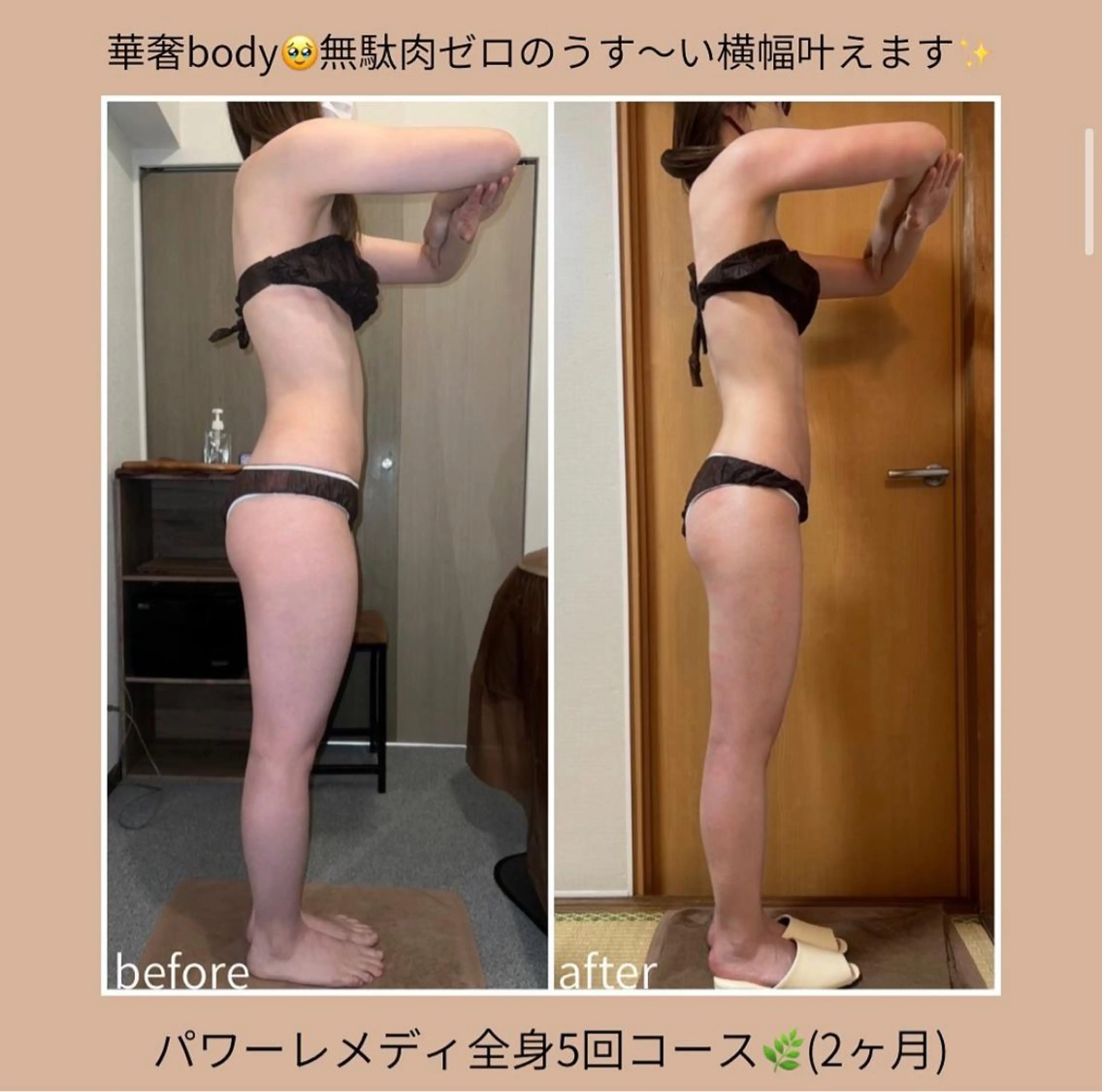 biloop所属・《本気痩せ×疲労改善 》 BILOOPのエステ・リラクイメージ