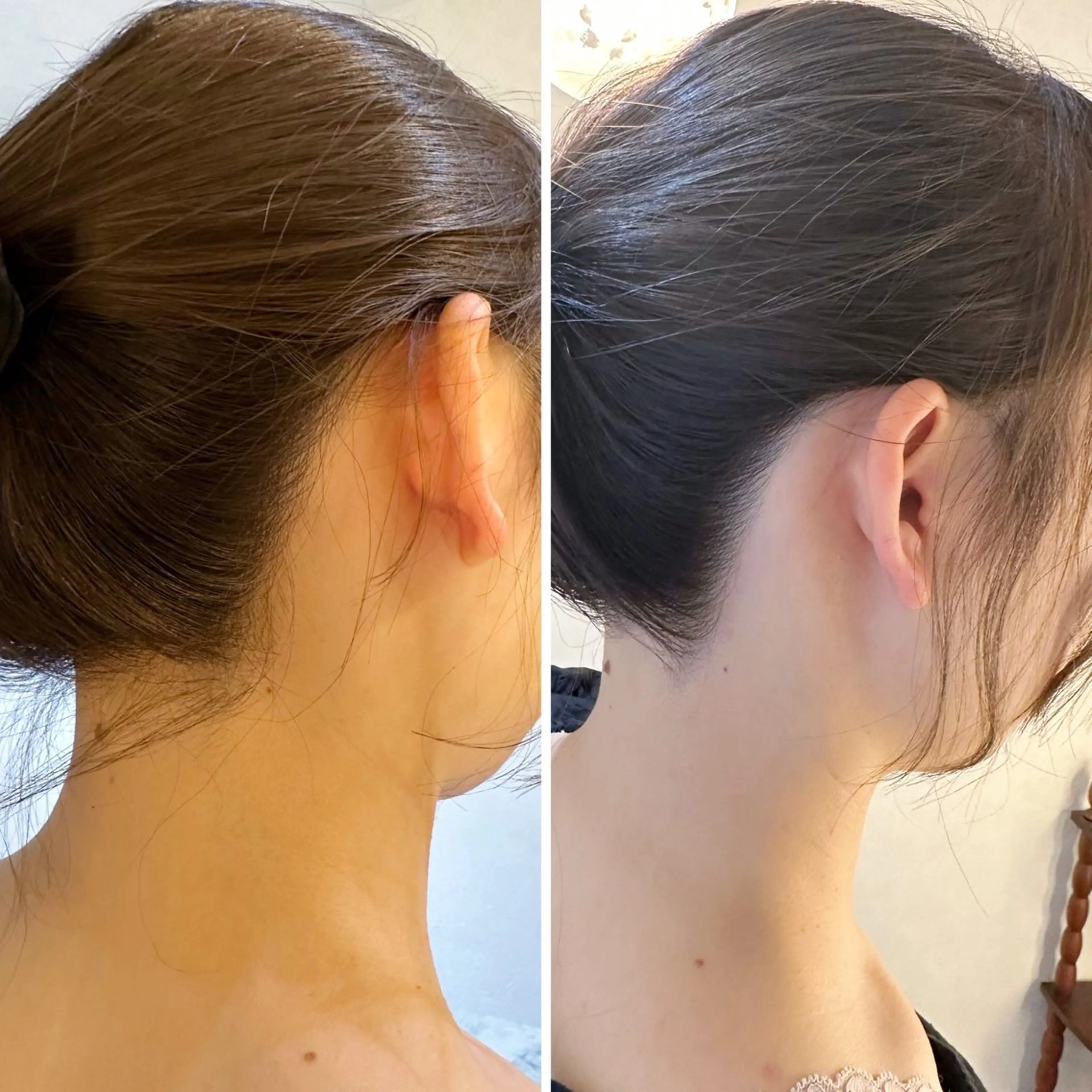 うなじ脱毛/美肌脱毛 LABELのエステ・リラクイメージ