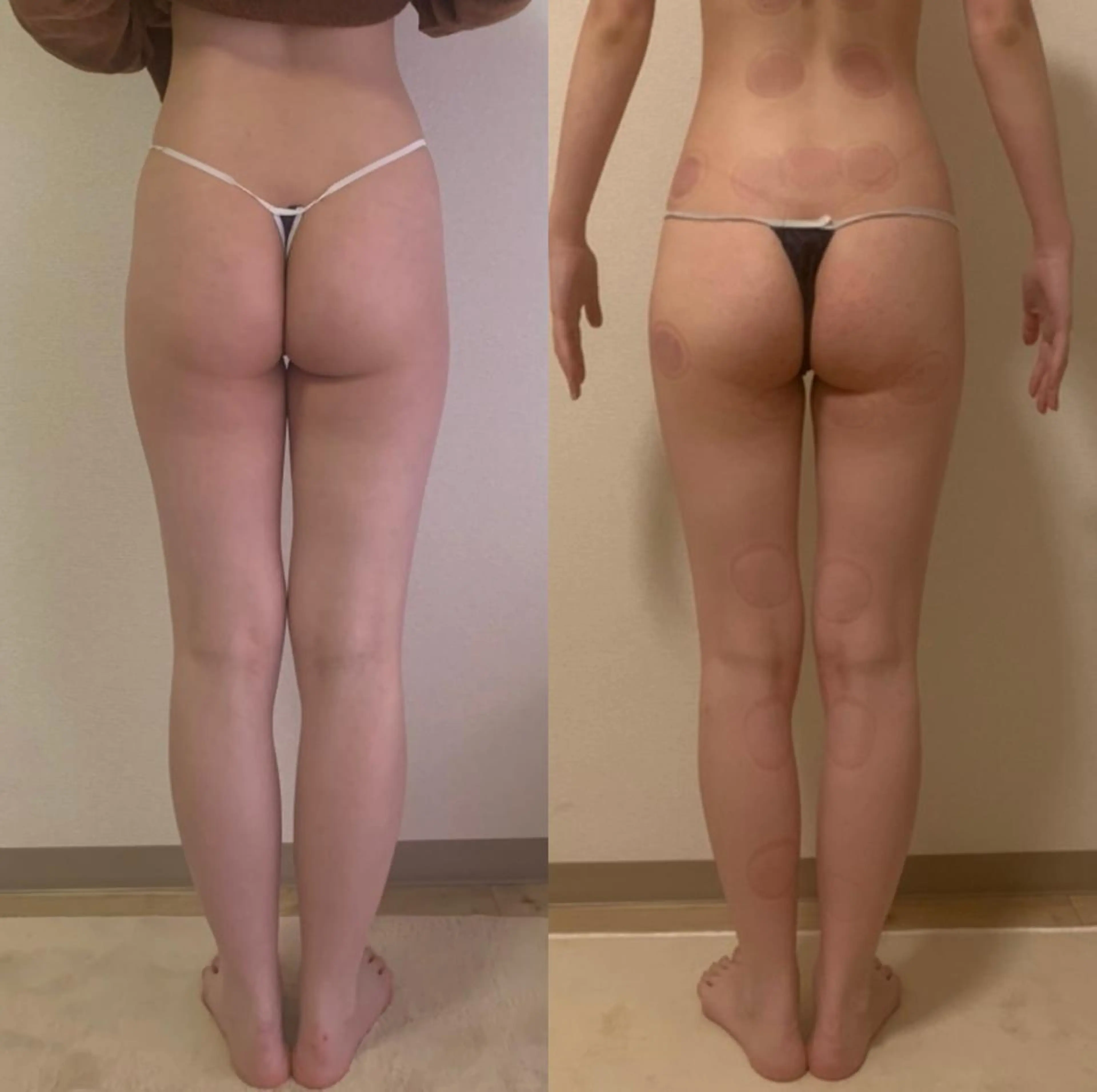 a  room salonのエステ・リラクイメージ