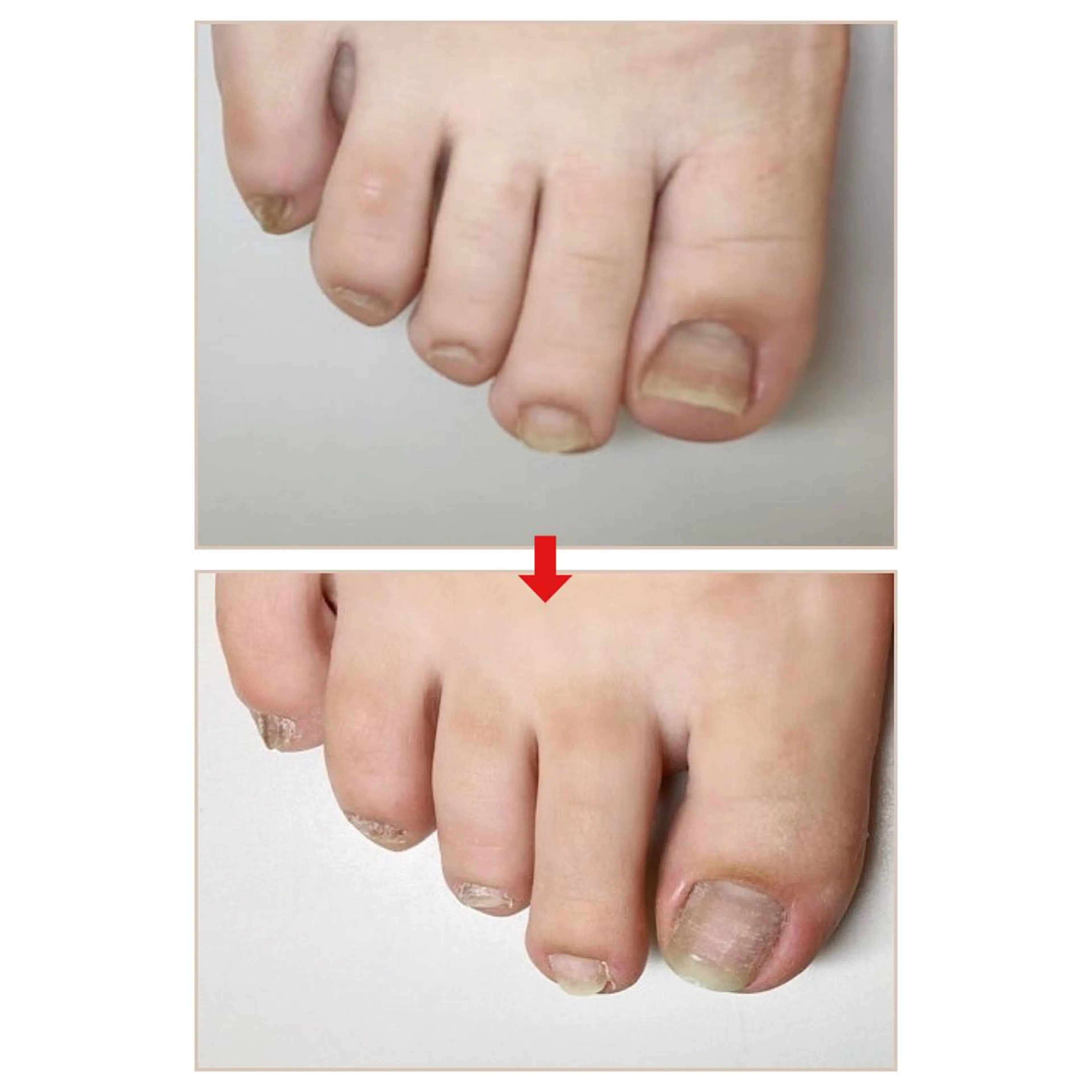 ネイル ネイルサロンアリューム所属・ネイルサロン アリュームのネイルデザイン