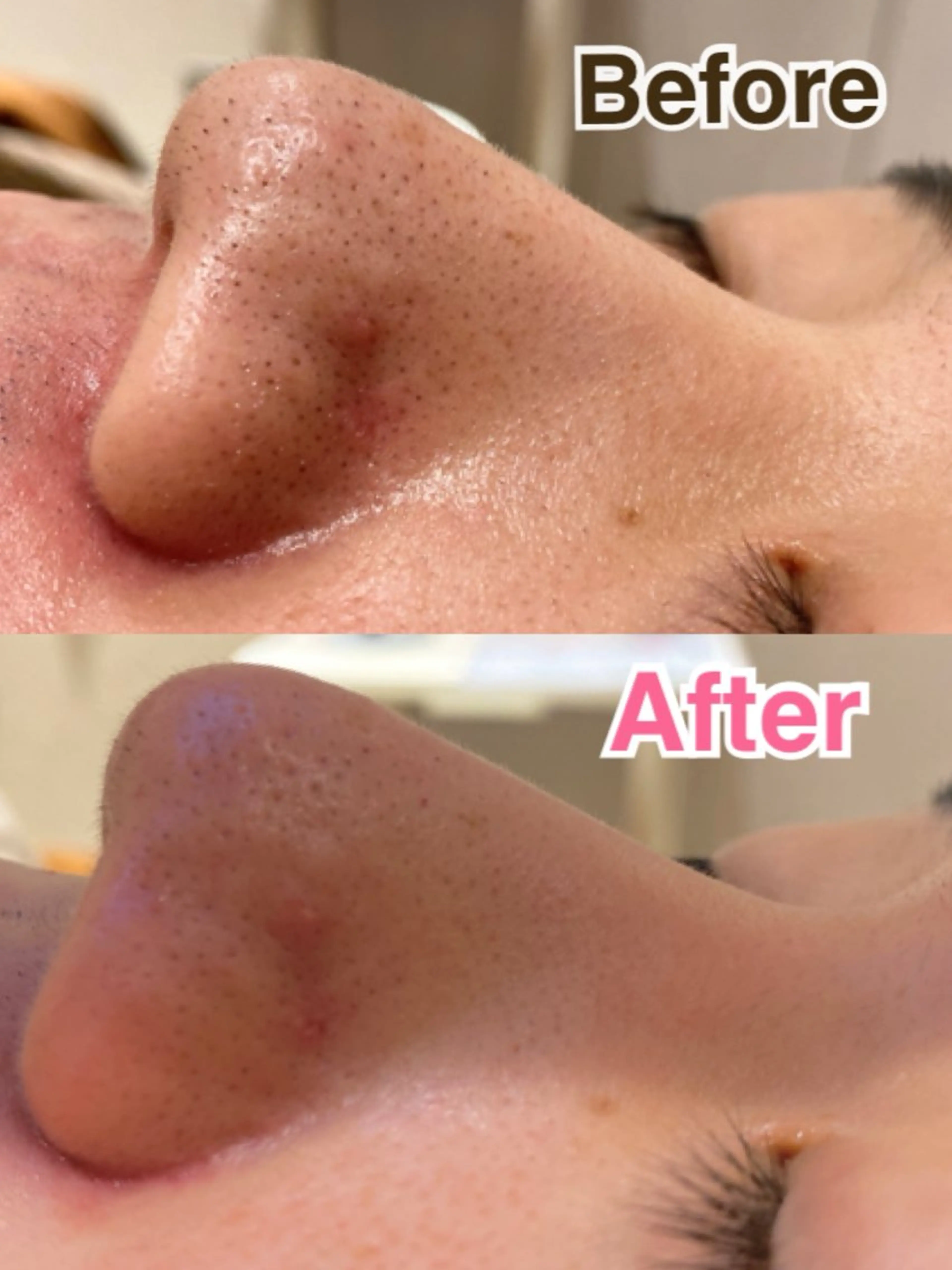 GRANLUXE所属・.*痩身.脱毛 リラク前田*･のエステ・リラクイメージ