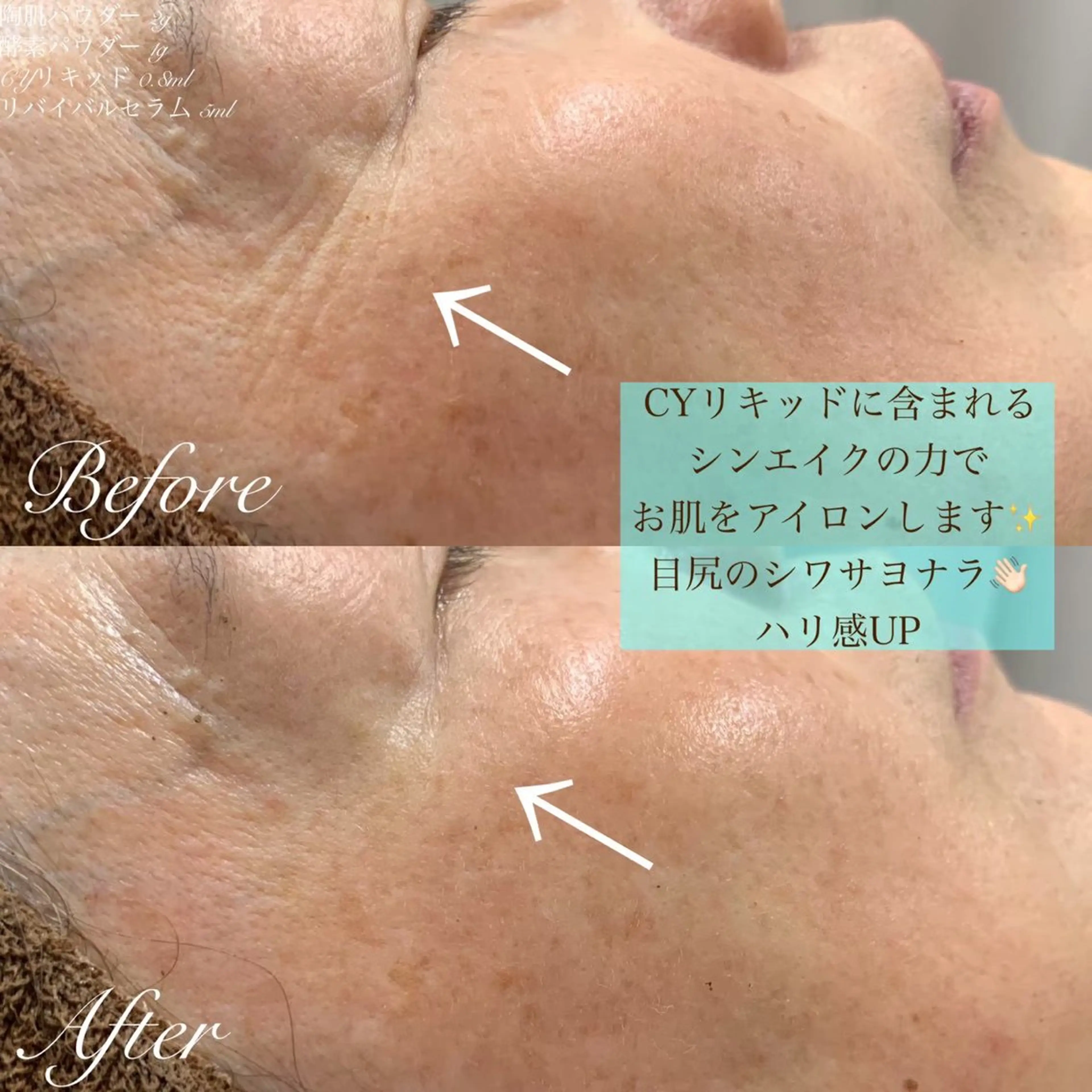 one day所属・肌質改善ハーブサロン ALA原宿のエステ・リラクイメージ