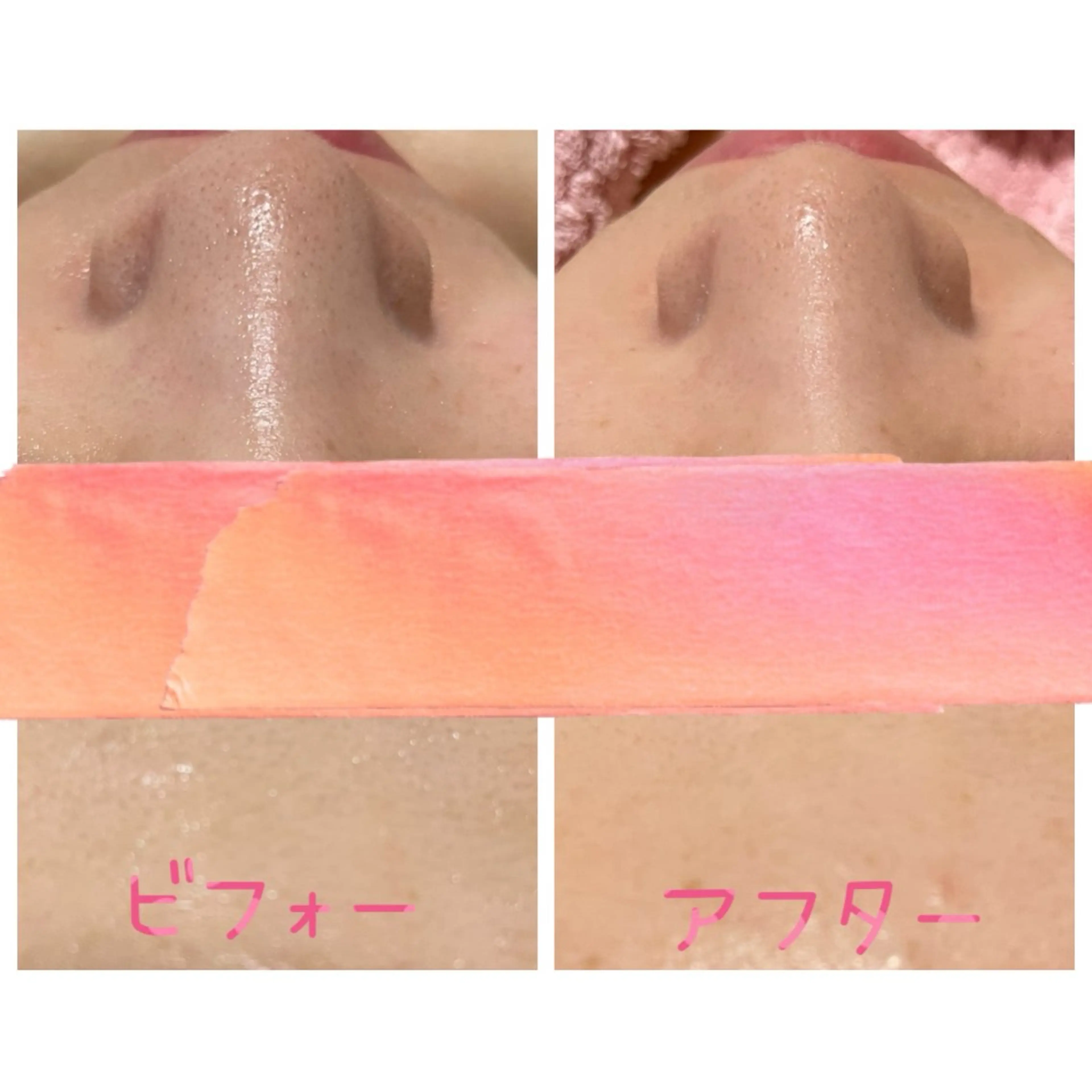 エステ 毛穴・リンパ・肌ケア サロン スリールのエステ・リラクイメージ