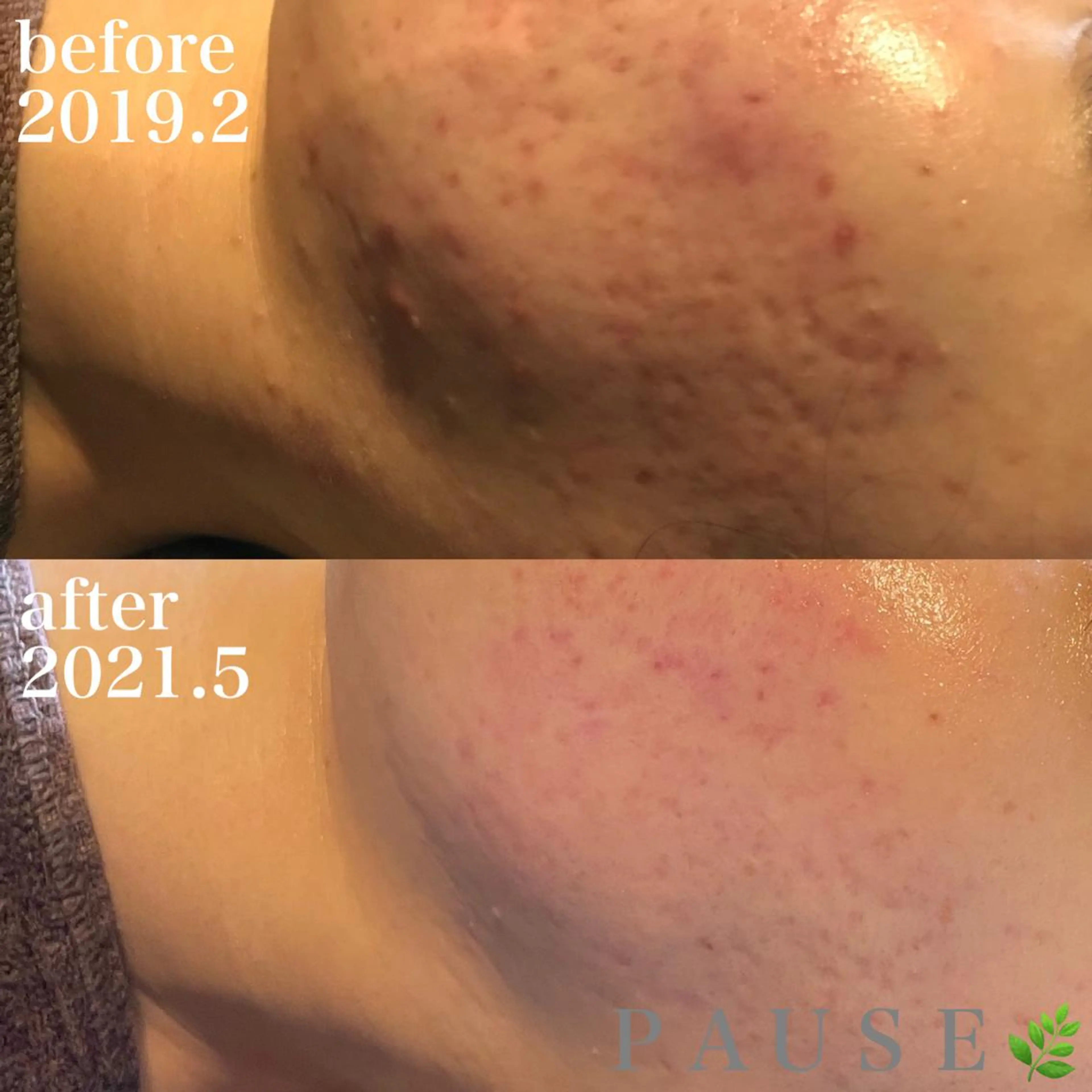 エステ 浜野 恵美のエステ・リラクイメージ