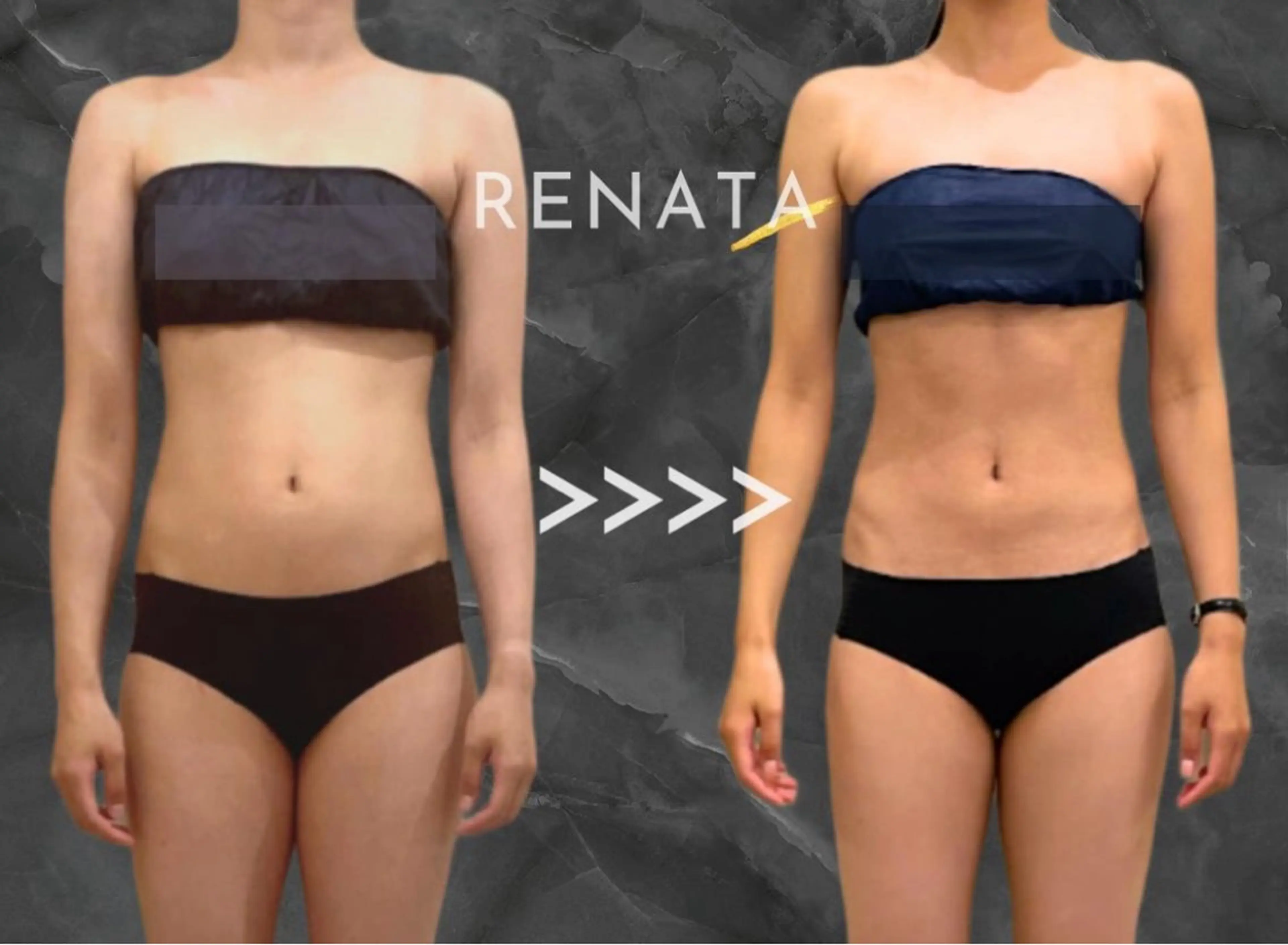 全員使える／冷却❄️痩身 お好きな部位8箇所モニターの写真