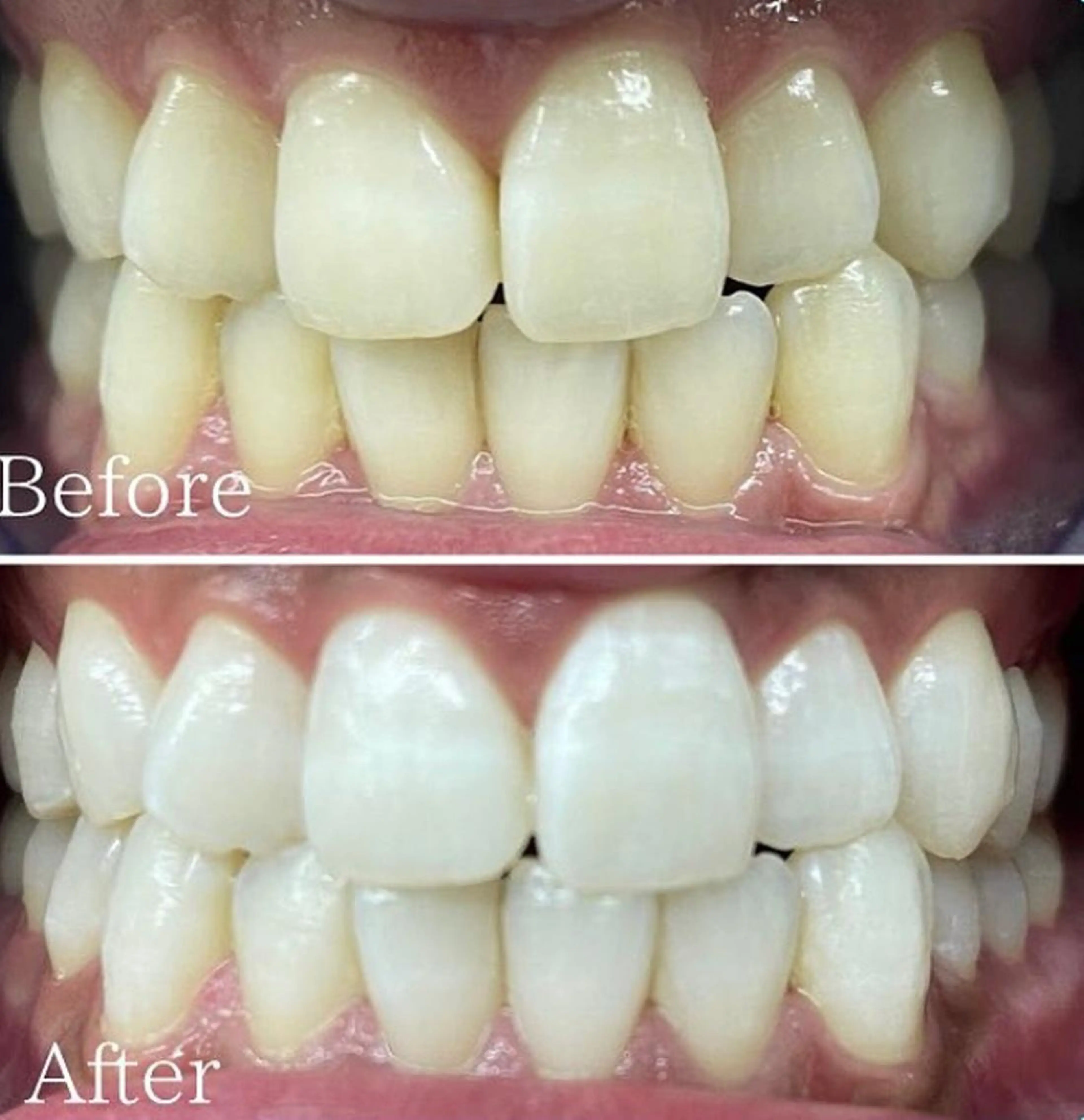 メンズ 学生（メンズ向け） その他 ホワイトニング専門店 WHITE天神店のエステ・リラクイメージ