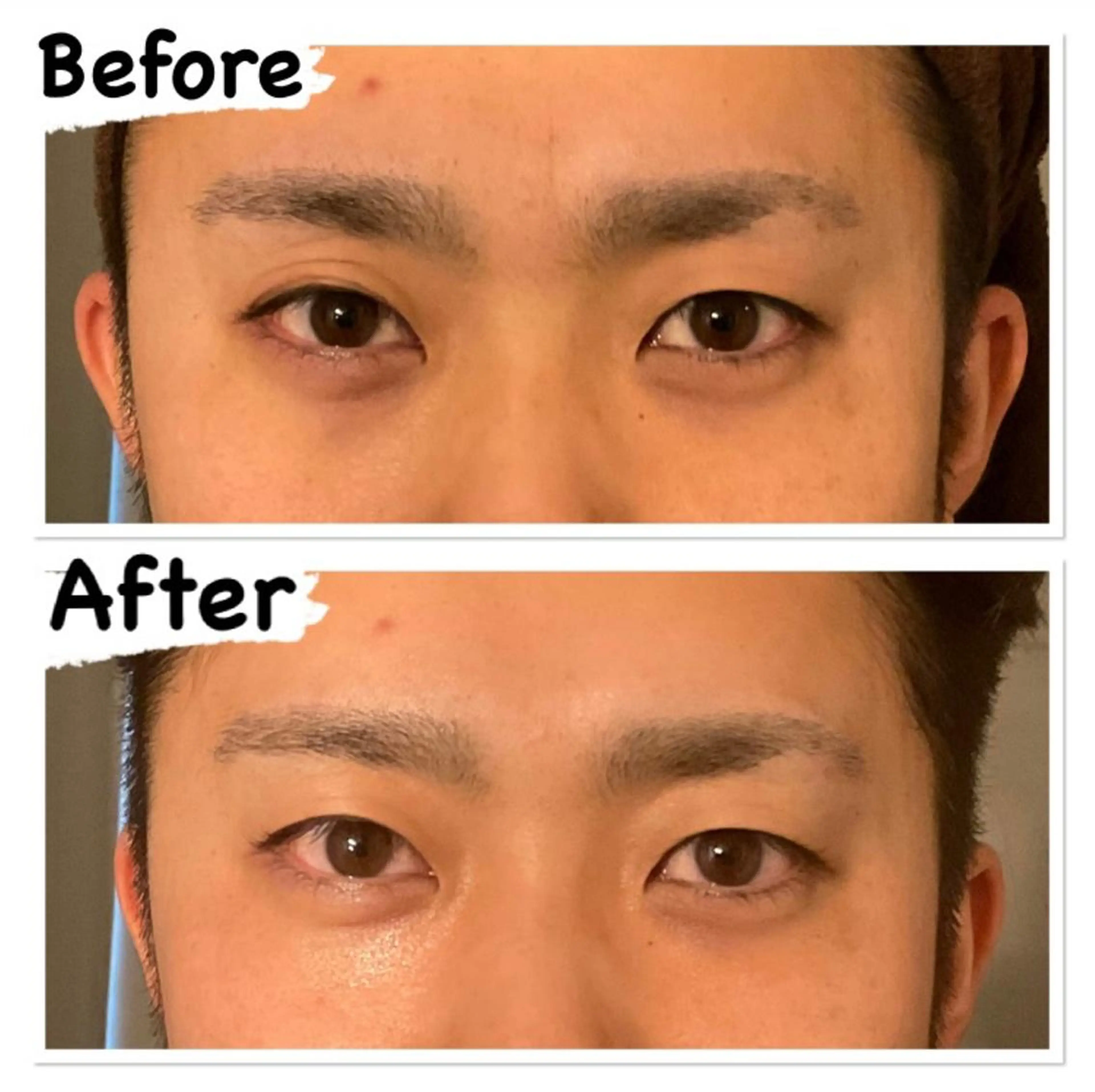 【メンズ限定】SP全顔コース　75分の写真