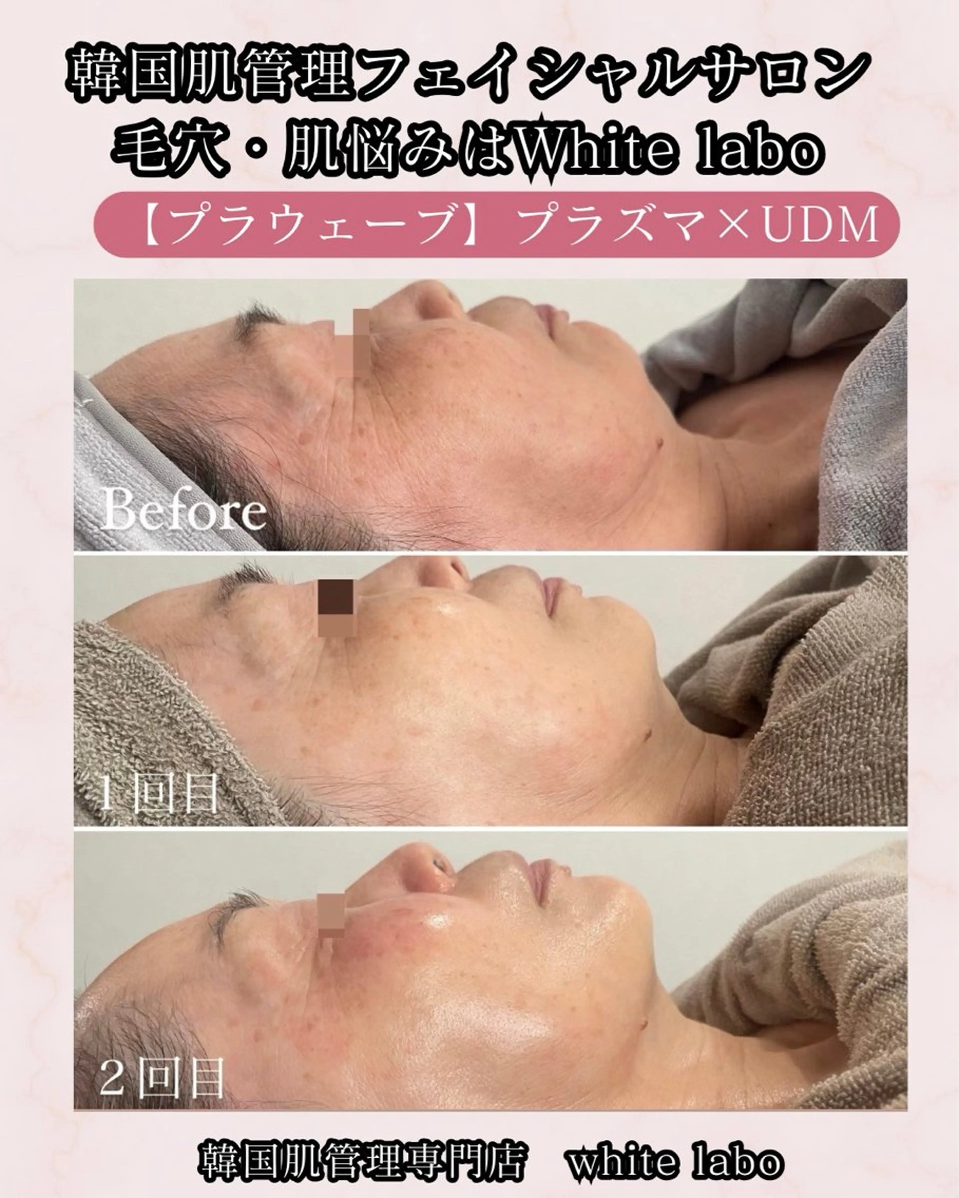 韓国肌管理専門店　White labo 梅田店所属・ホワイトラボ梅田 ｜毛穴・韓国肌管理のエステ・リラクイメージ
