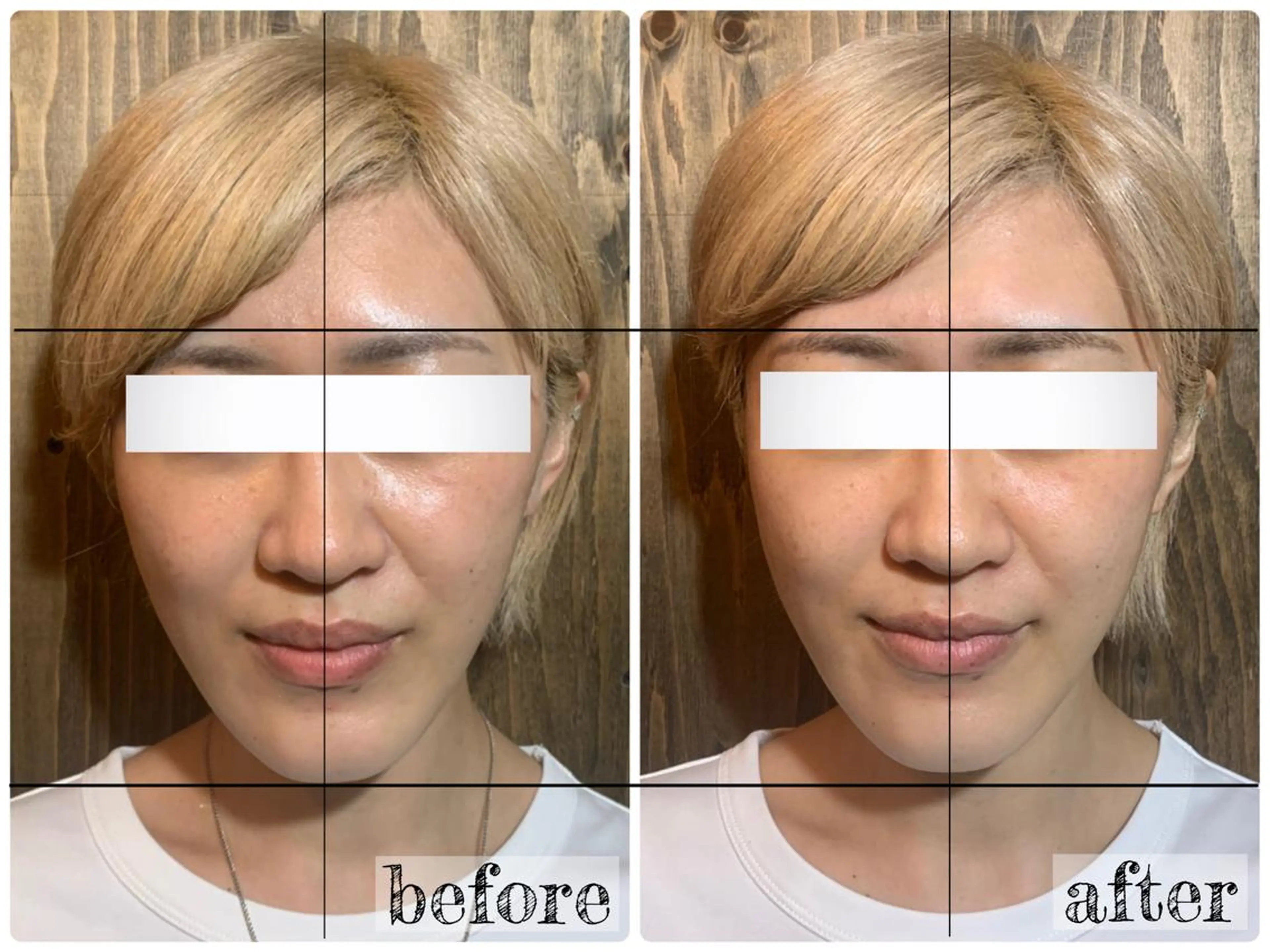 エステ リラク 💎後悔させない小顔 矯正💎イトヤマ🌱のエステ・リラクイメージ