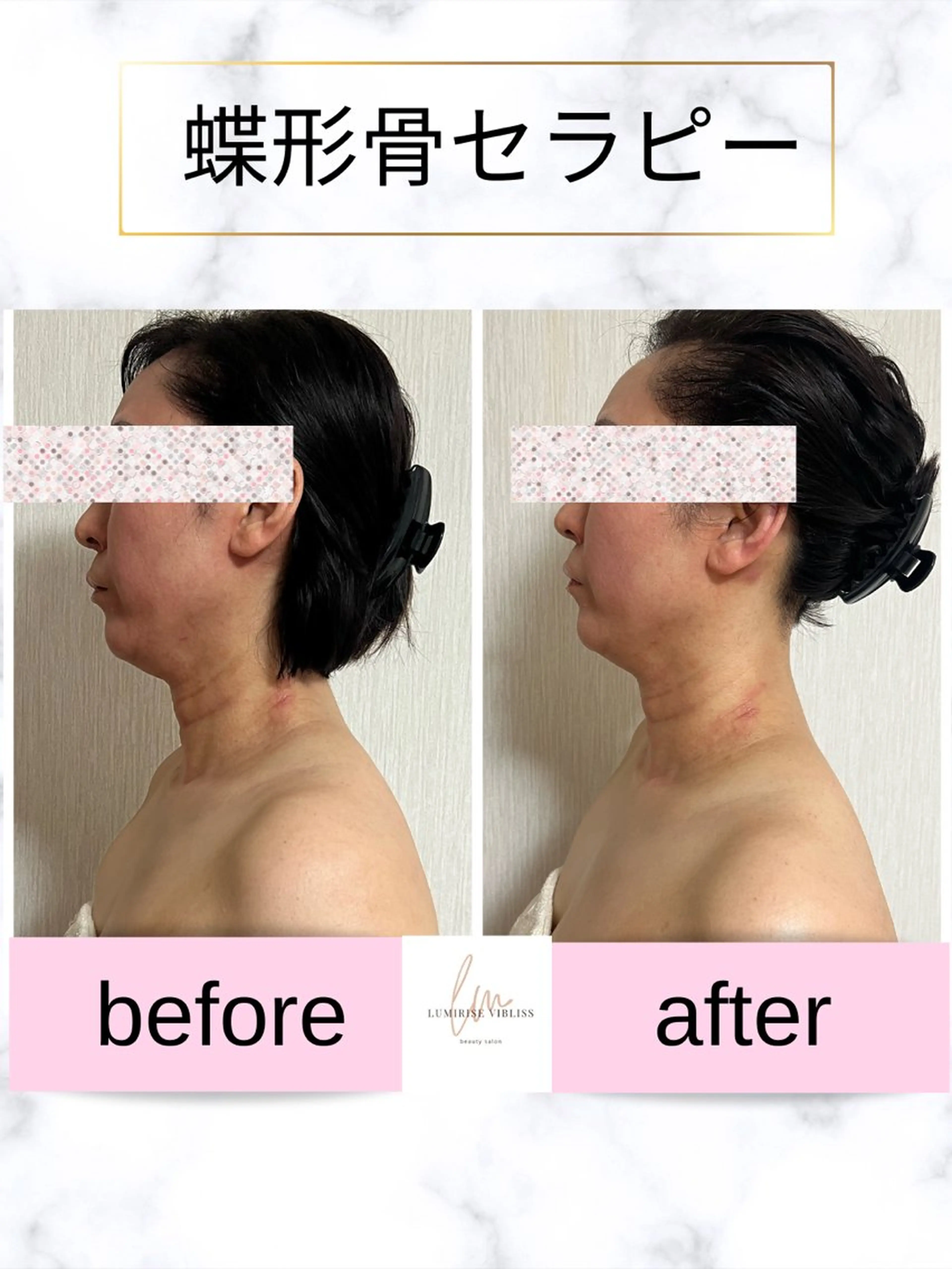 lumirise viblissのエステ・リラクイメージ