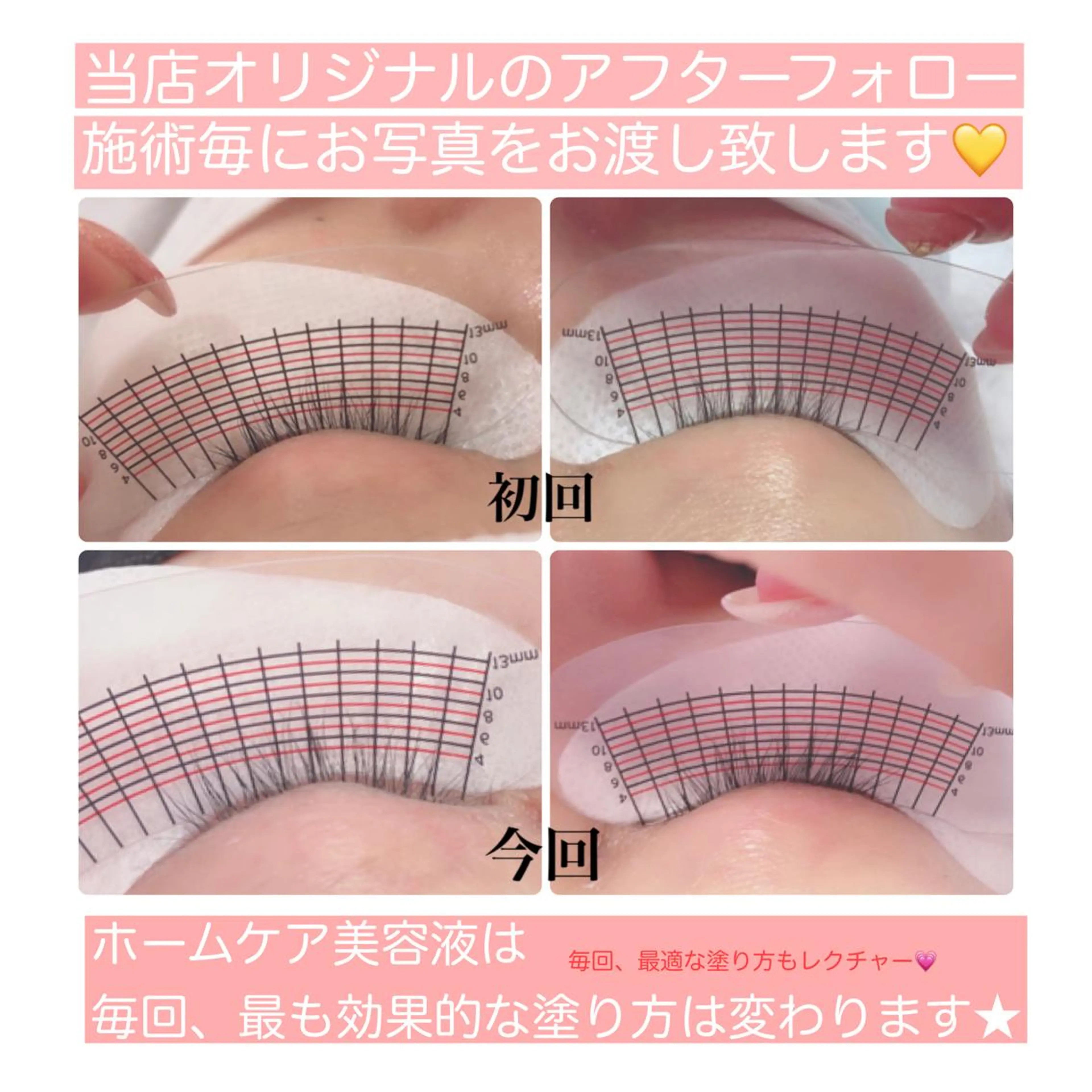 〈ラッシュアディクト（まつ毛ケア）〉¥4378ーインスタ&雑誌各社に紹介多数掲載💛最高級育毛サロン専門ケア(1回)の写真