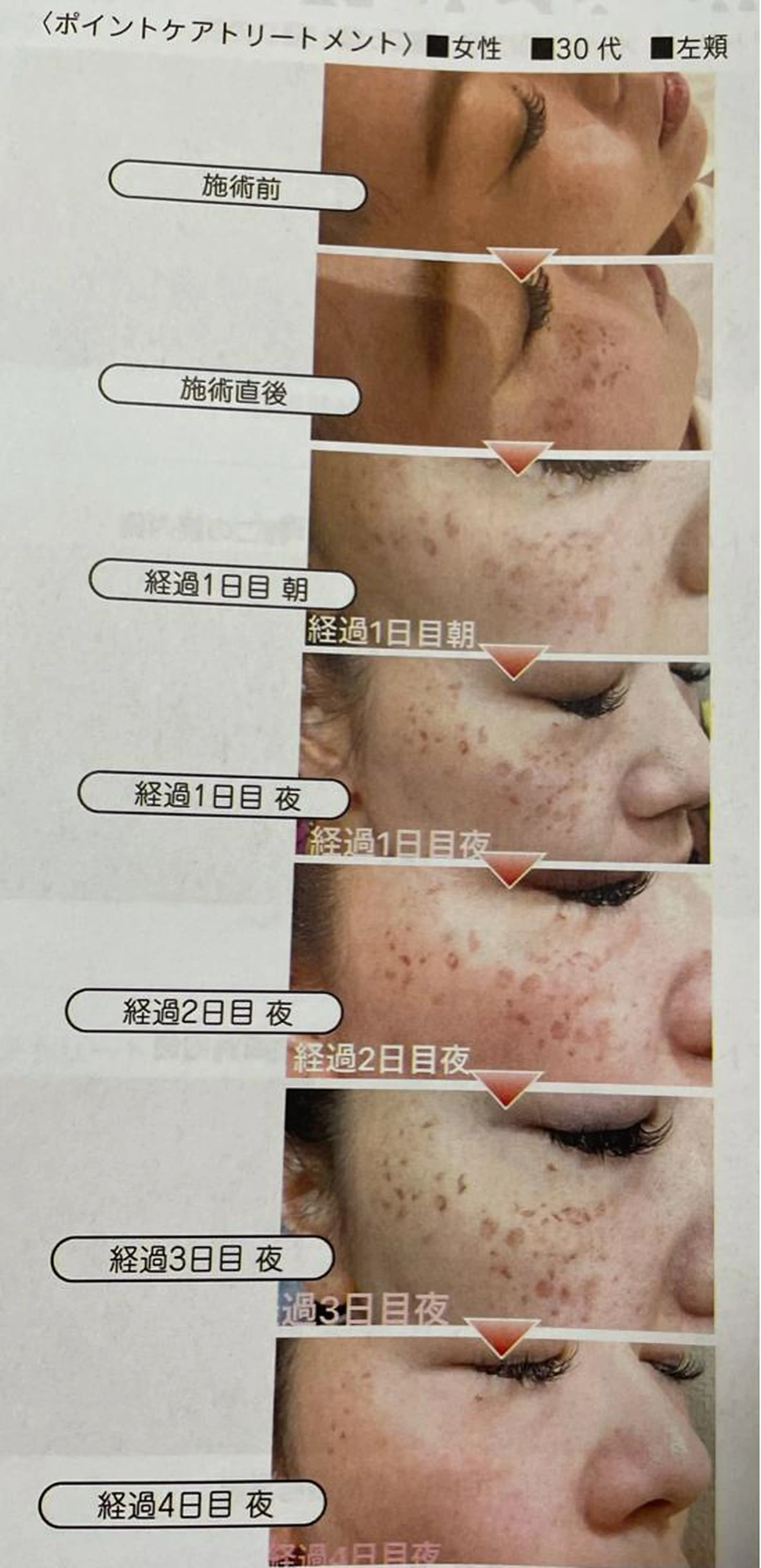 筋膜ホワイトの写真