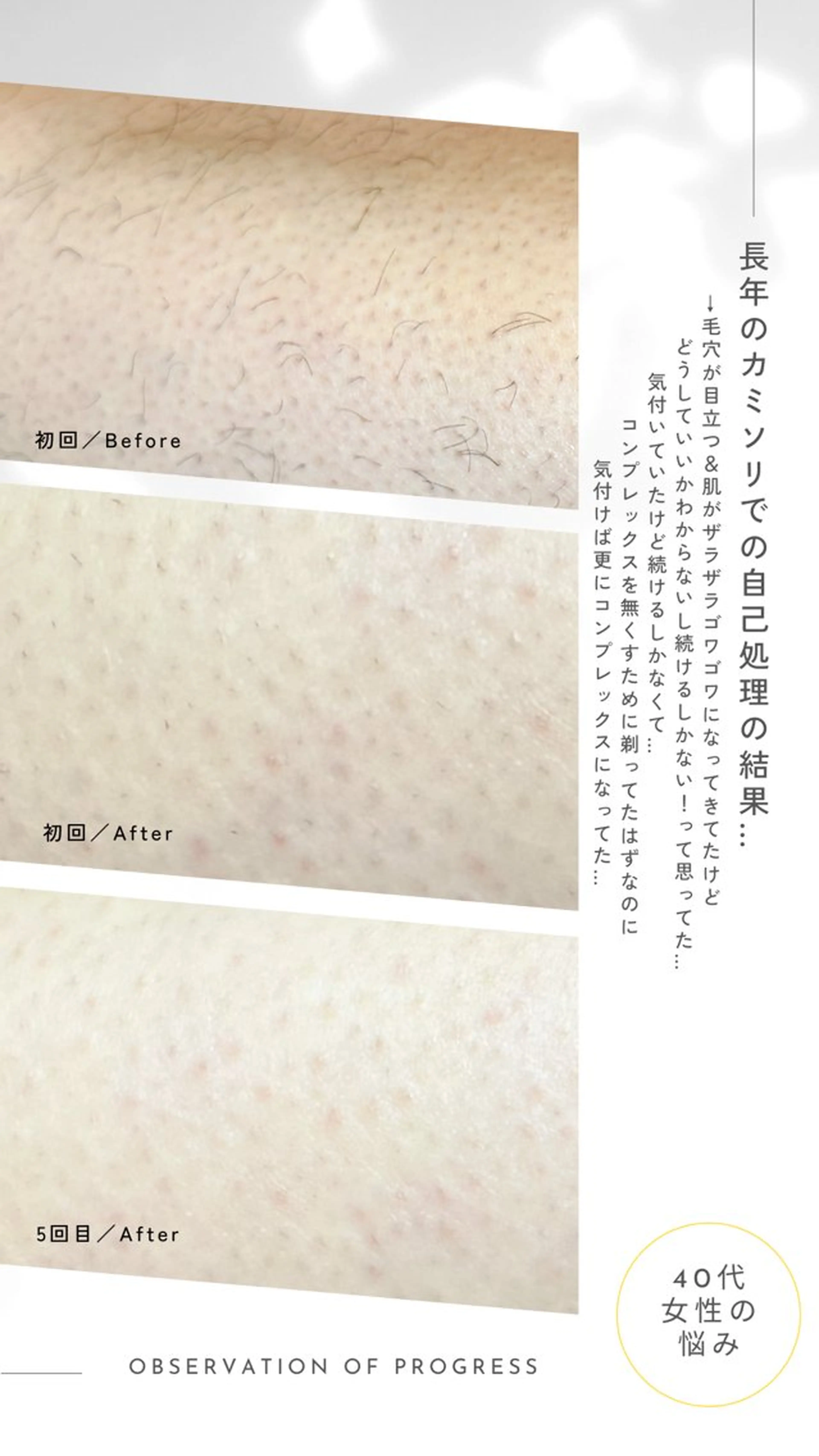 Hit. シュガーリング豊橋のエステ・リラクイメージ