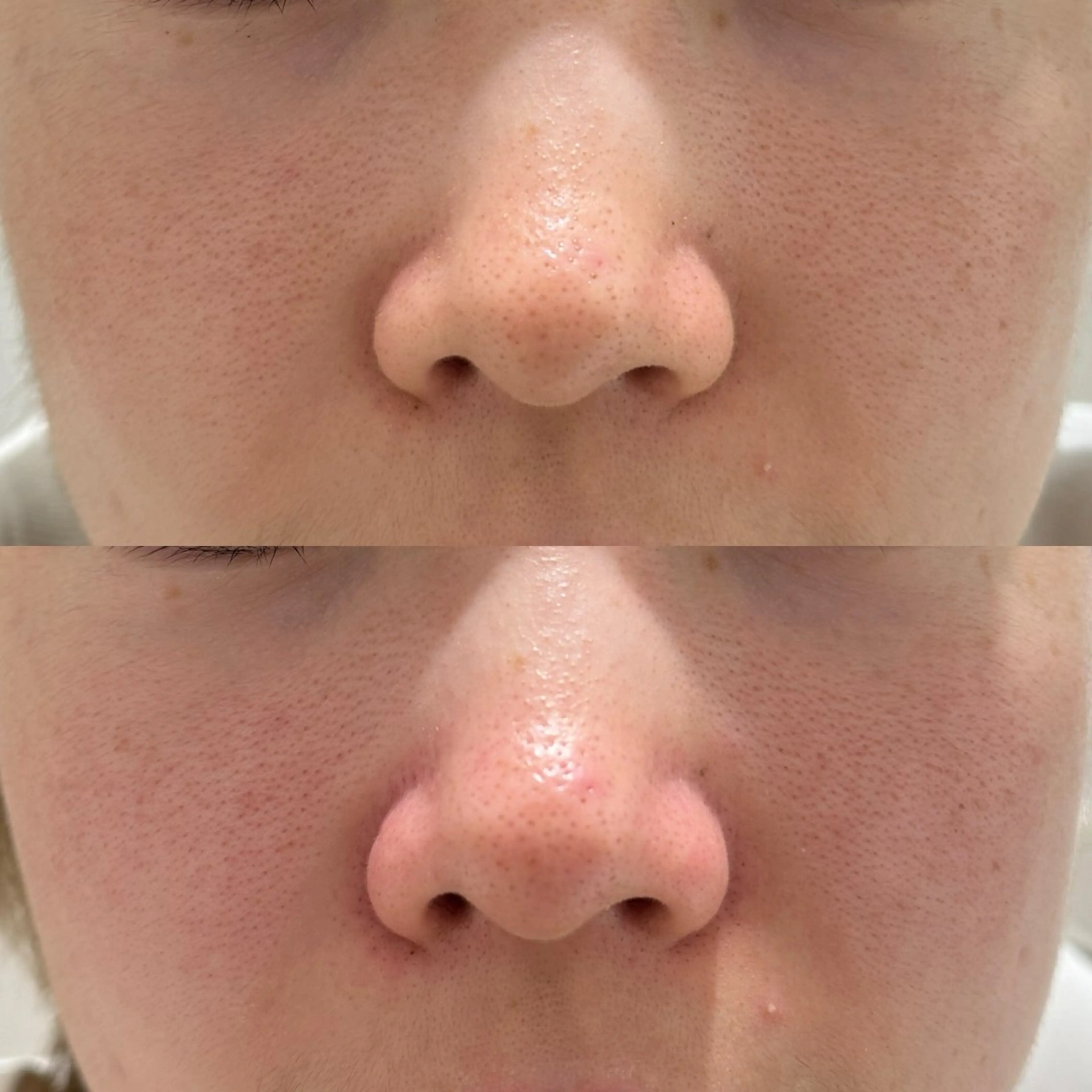 アピタ千代田橋店 POLA THE BEAUTY所属・エステ ツヤ肌 マッサージ POLAのその他イメージ