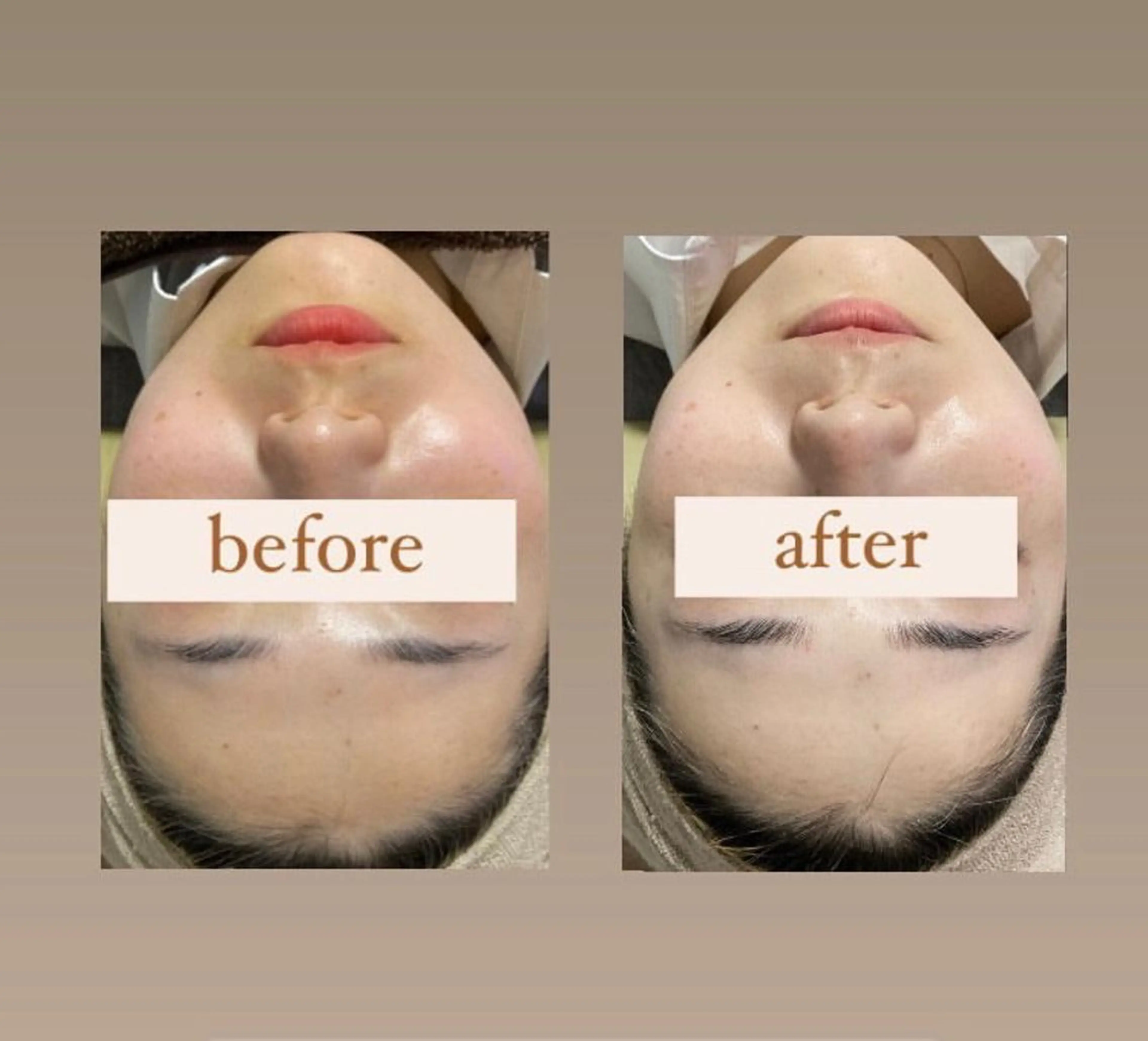 エステ crescent所属・【韓国肌管理・脱毛】 クレセントのその他イメージ