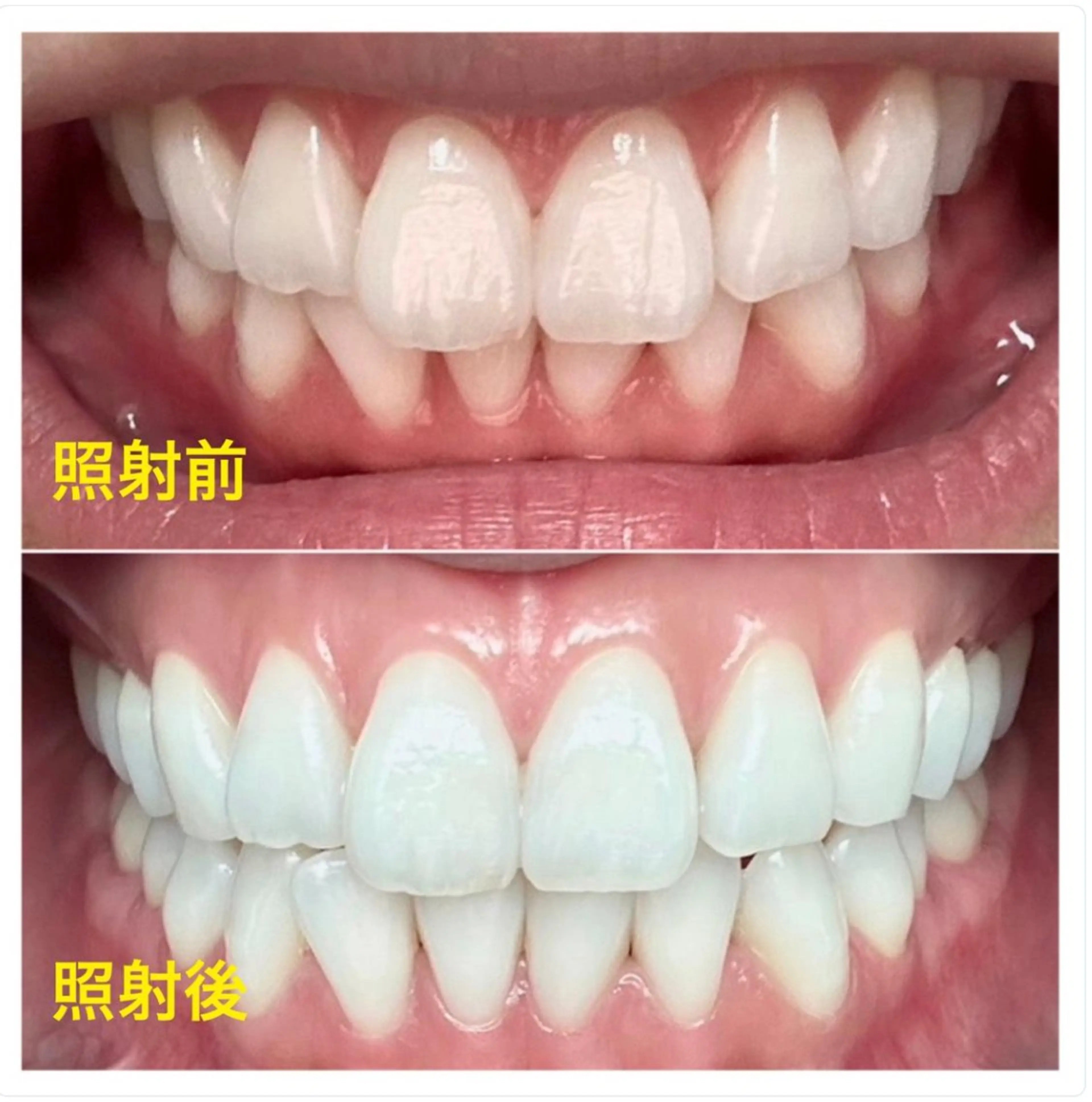 ホワイトニングジム 池袋のその他イメージ