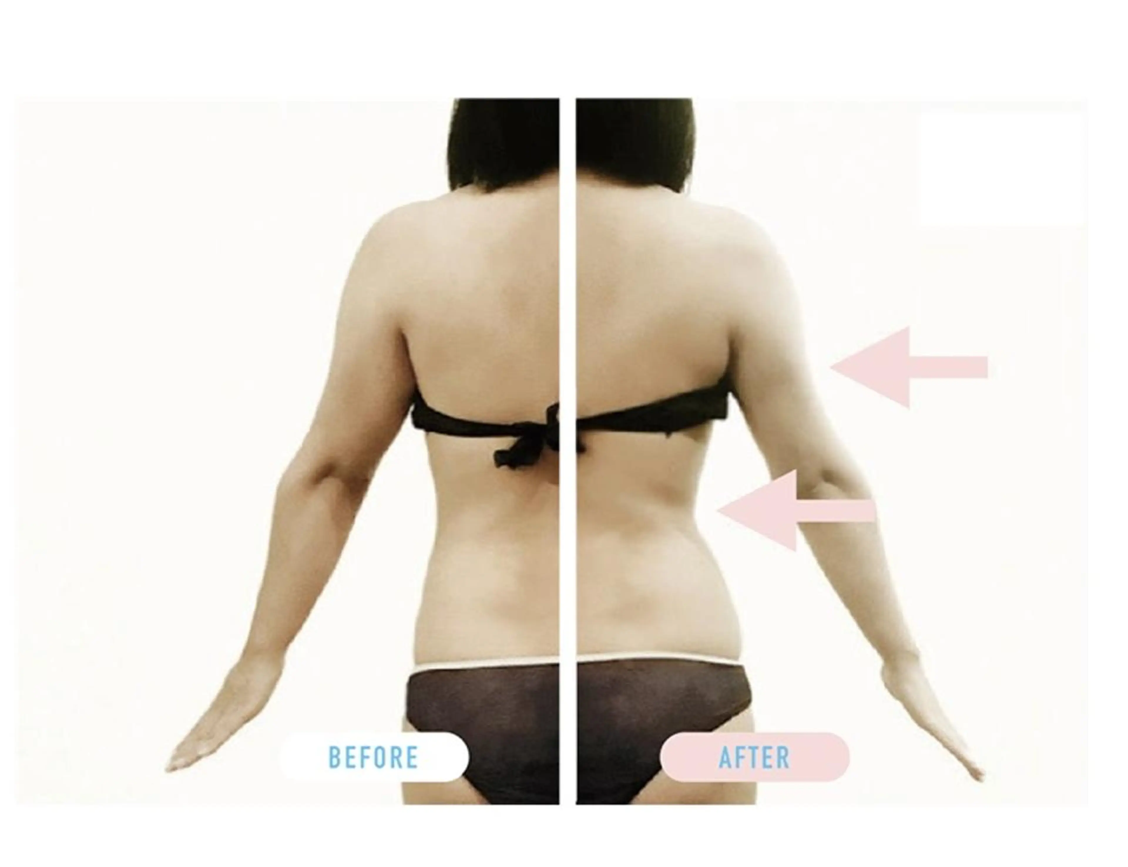 エステ DANDELION ハイフ:脱毛のエステ・リラクイメージ