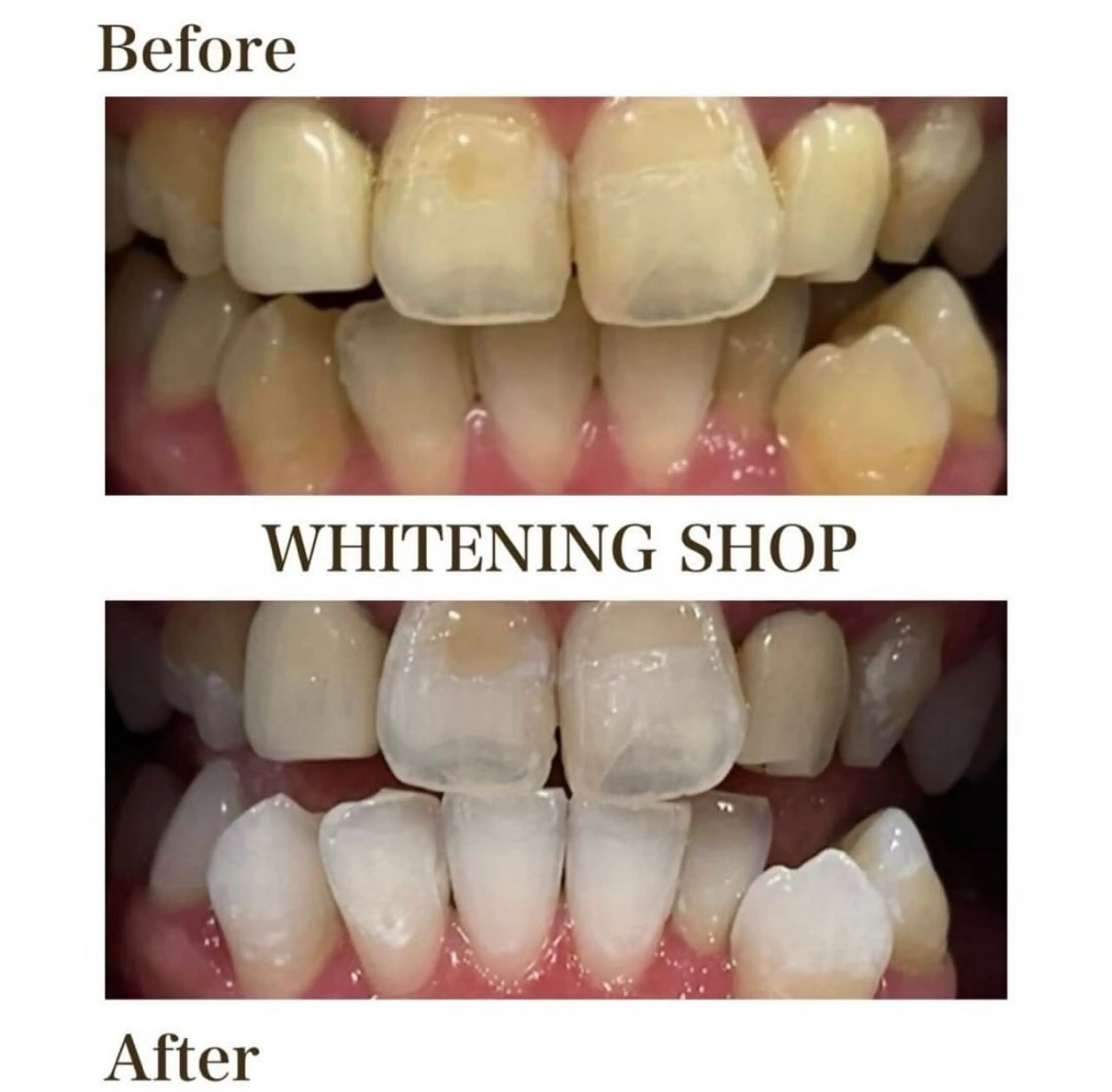 ホワイトニングショップ伊丹店所属・ホワイトニング ショップ伊丹店のその他イメージ