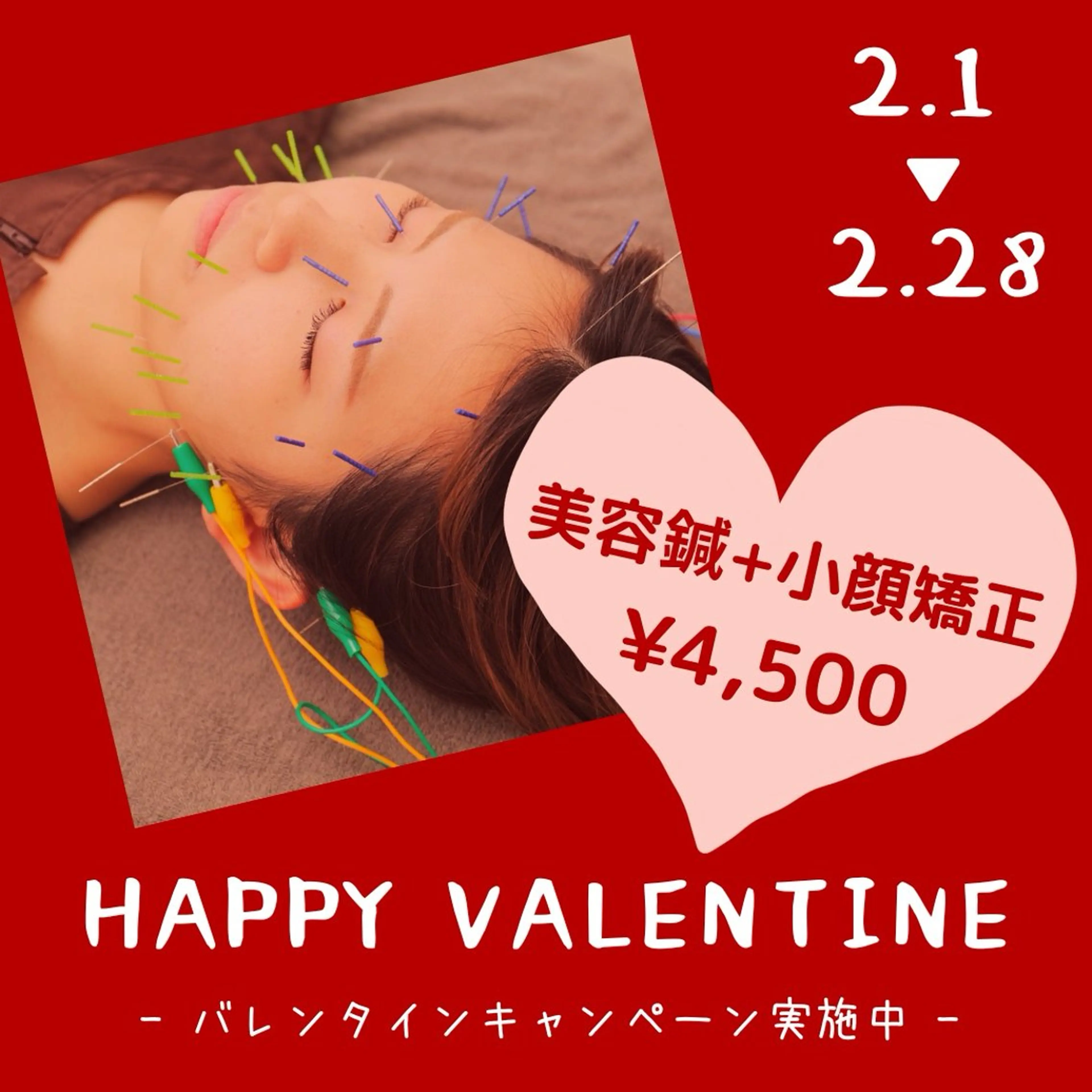 【📣平日限定📣】美容鍼+小顔矯正+ドライヘッドスパ(60分)の写真