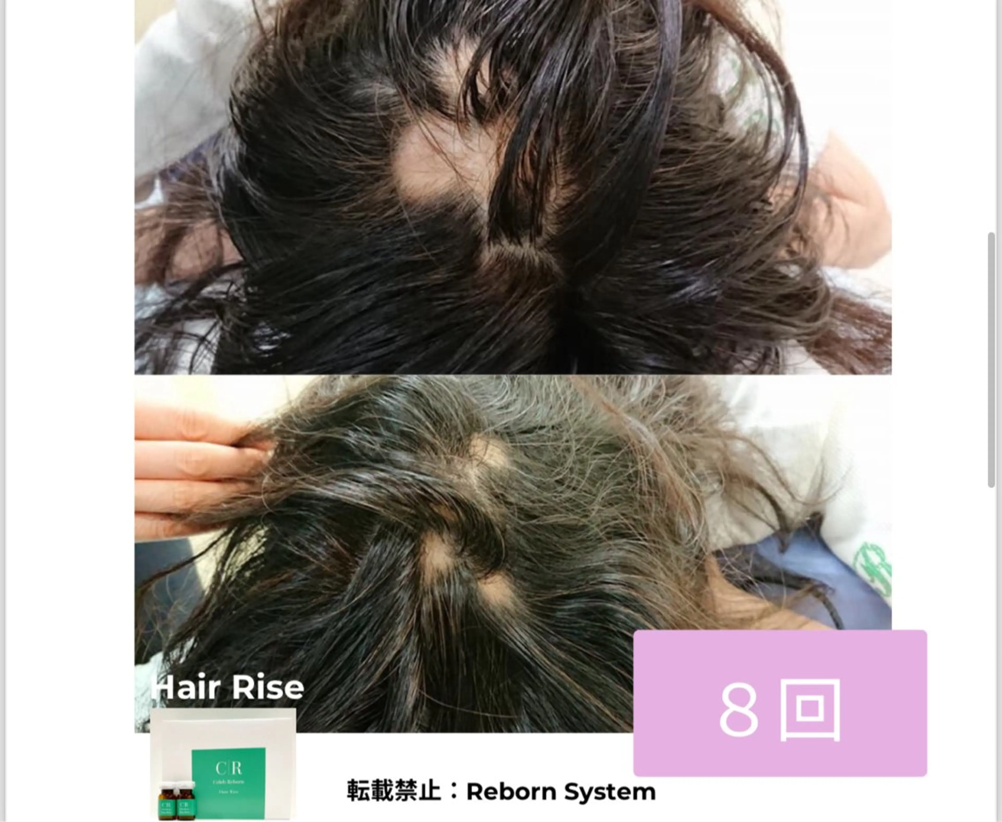 【福岡市西区 エステ】 GRANVIR(グランヴィール)所属・GRANVIR グランヴィールのエステ・リラクイメージ