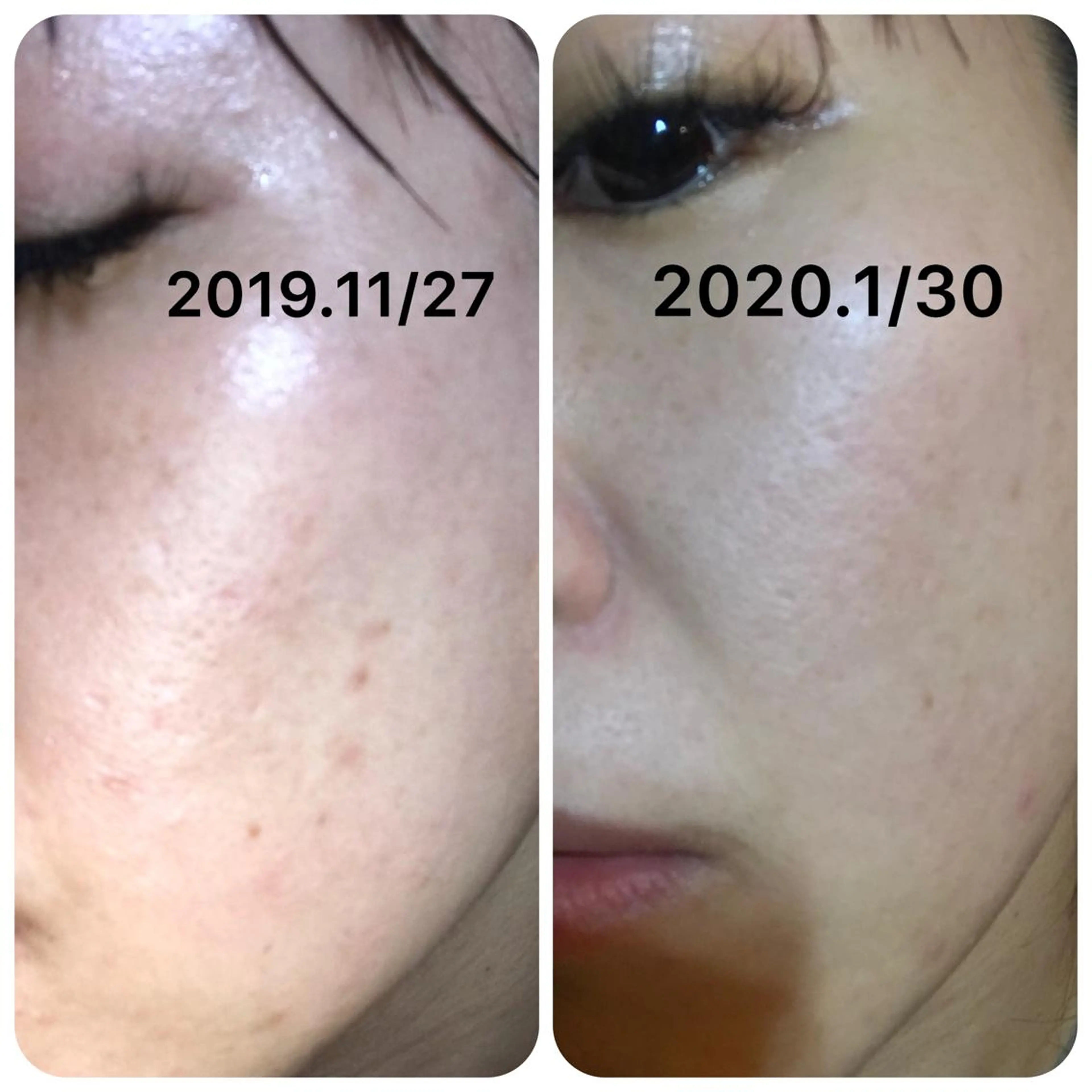 エステ 【足圧】鬼👹リンパ 身体整うサロンのエステ・リラクイメージ