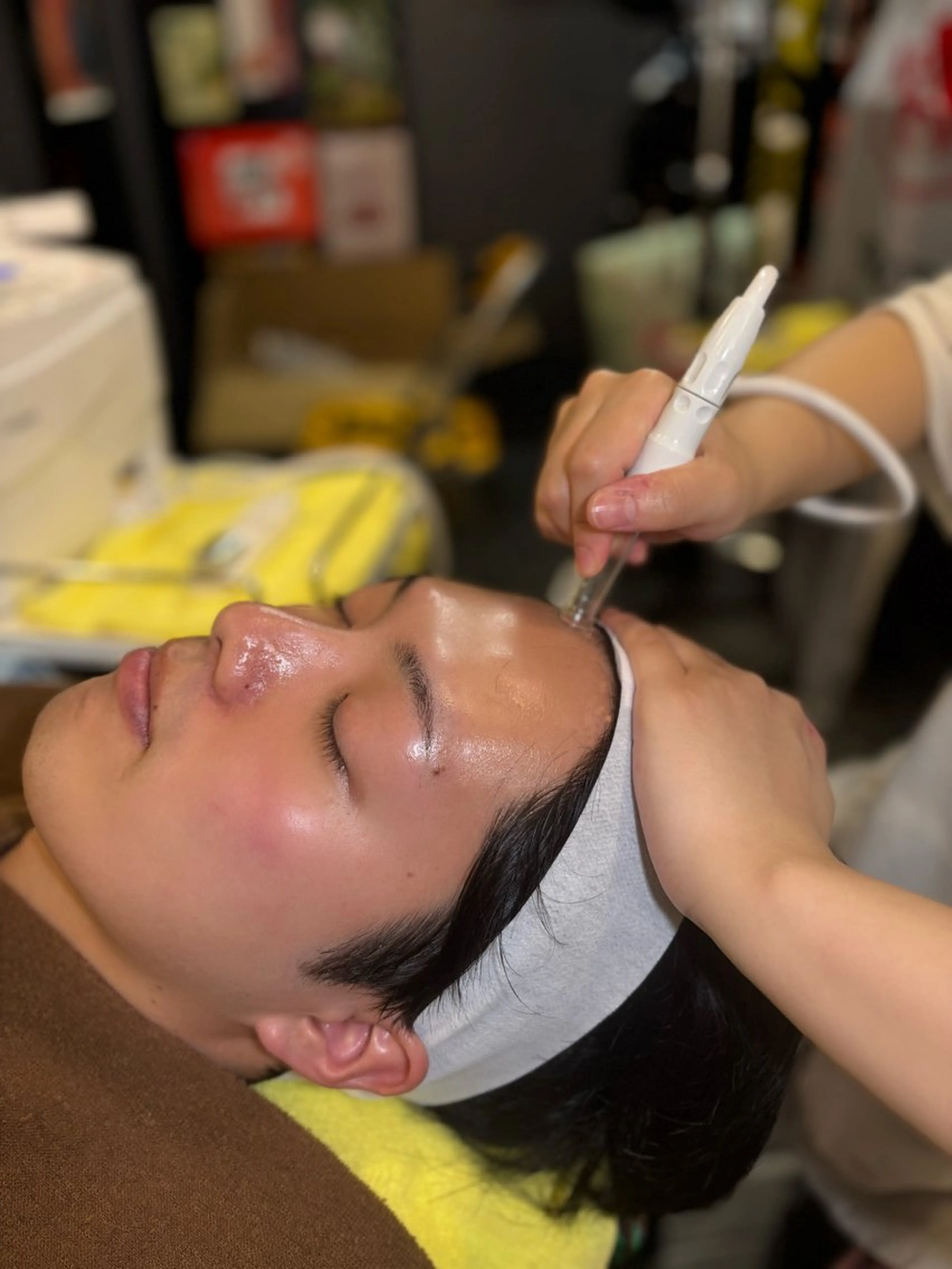 【メンズ歓迎】全顔ワックス脱毛＋フェイシャルエステの写真