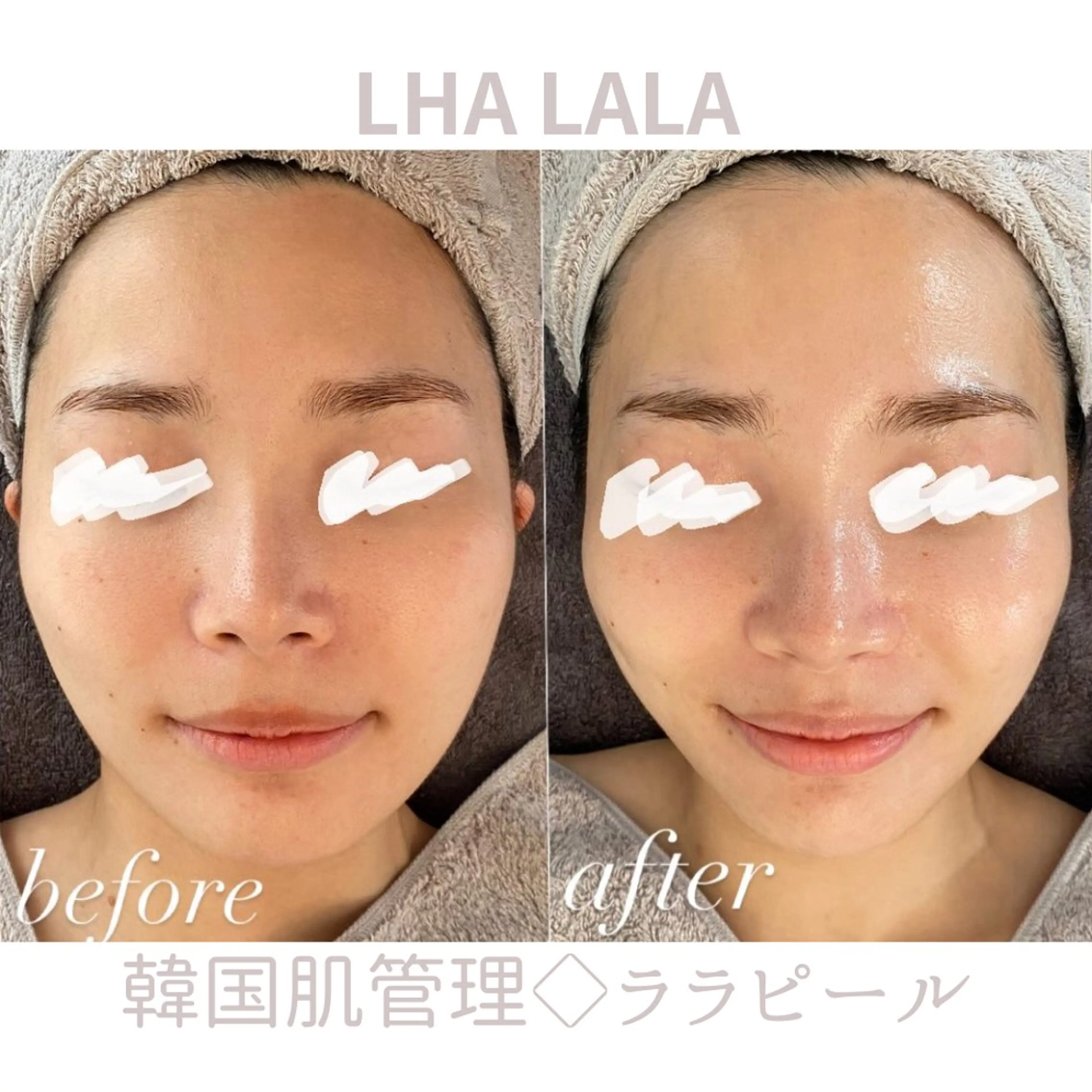 エステ リラク For...天王寺店 リンパ|ヘッドよもぎのエステ・リラクイメージ