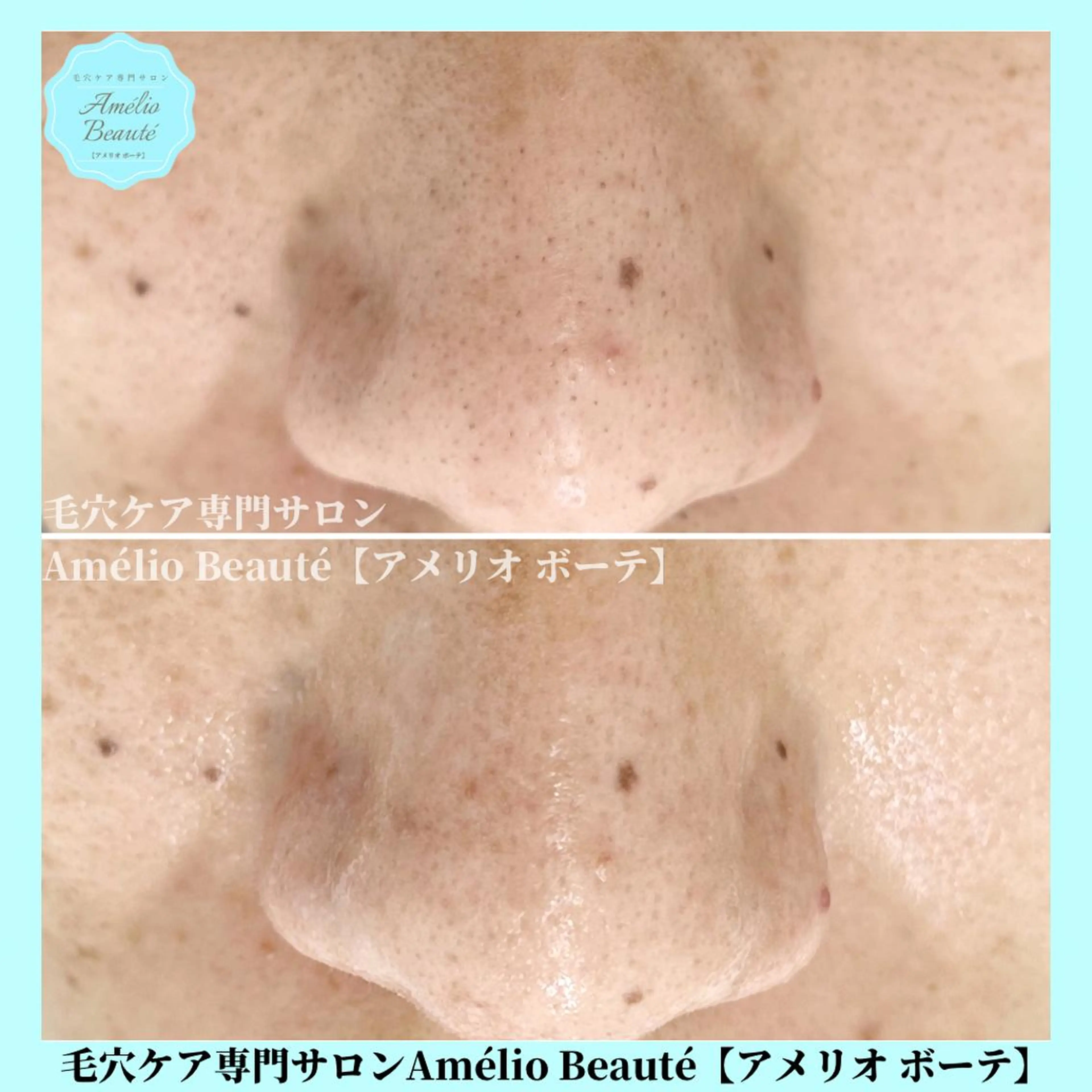 毛穴ケア専門サロン Amélio Beauté所属・毛穴ケア専門サロン アメリオボーテのその他イメージ