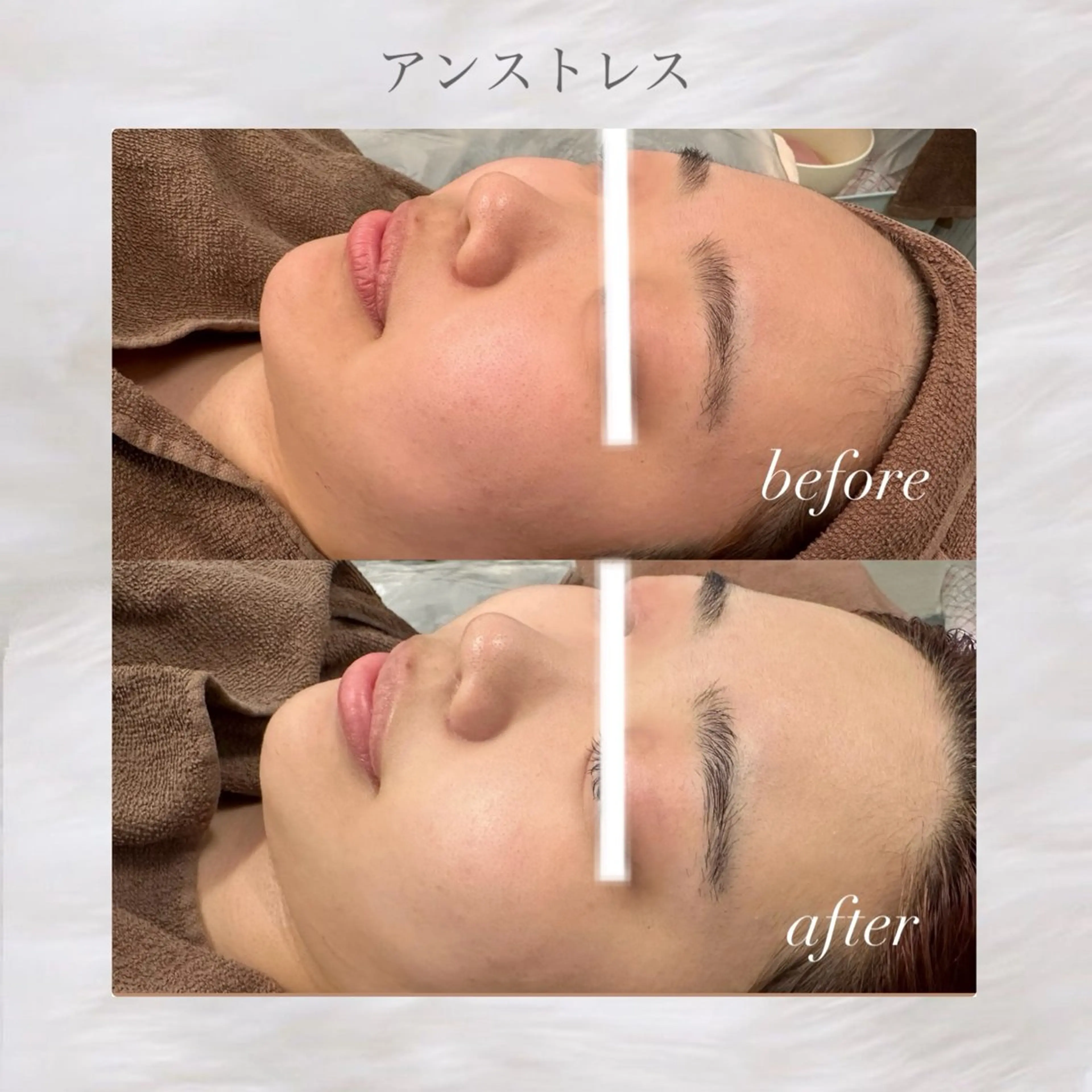 エステ 🦋美肌サロン. maho🦋のエステ・リラクイメージ