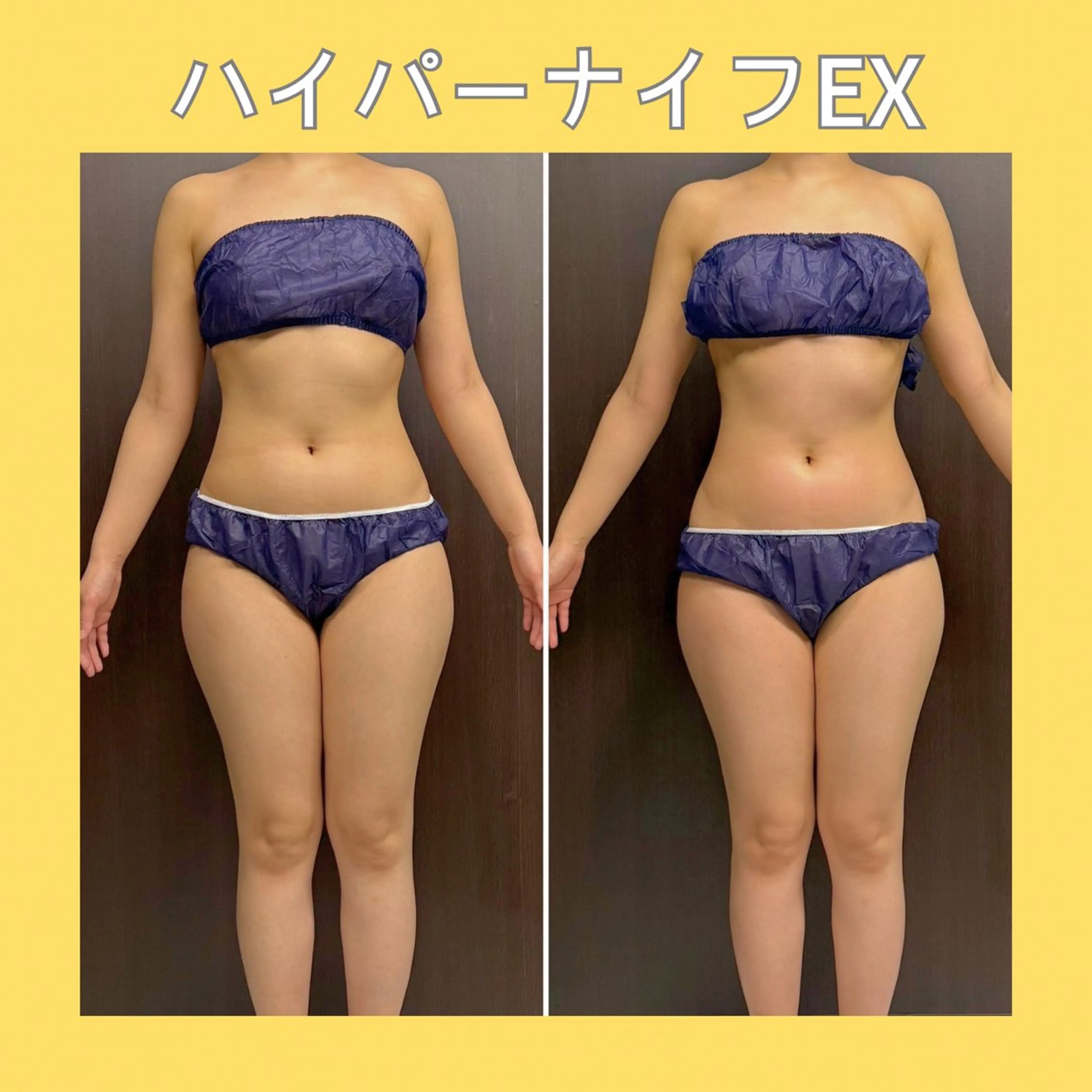 ハイパーナイフEXお好きな2パーツ当て放題❤️初めての方も安心👐気になるパーツだけケアしたい方に🔥の写真