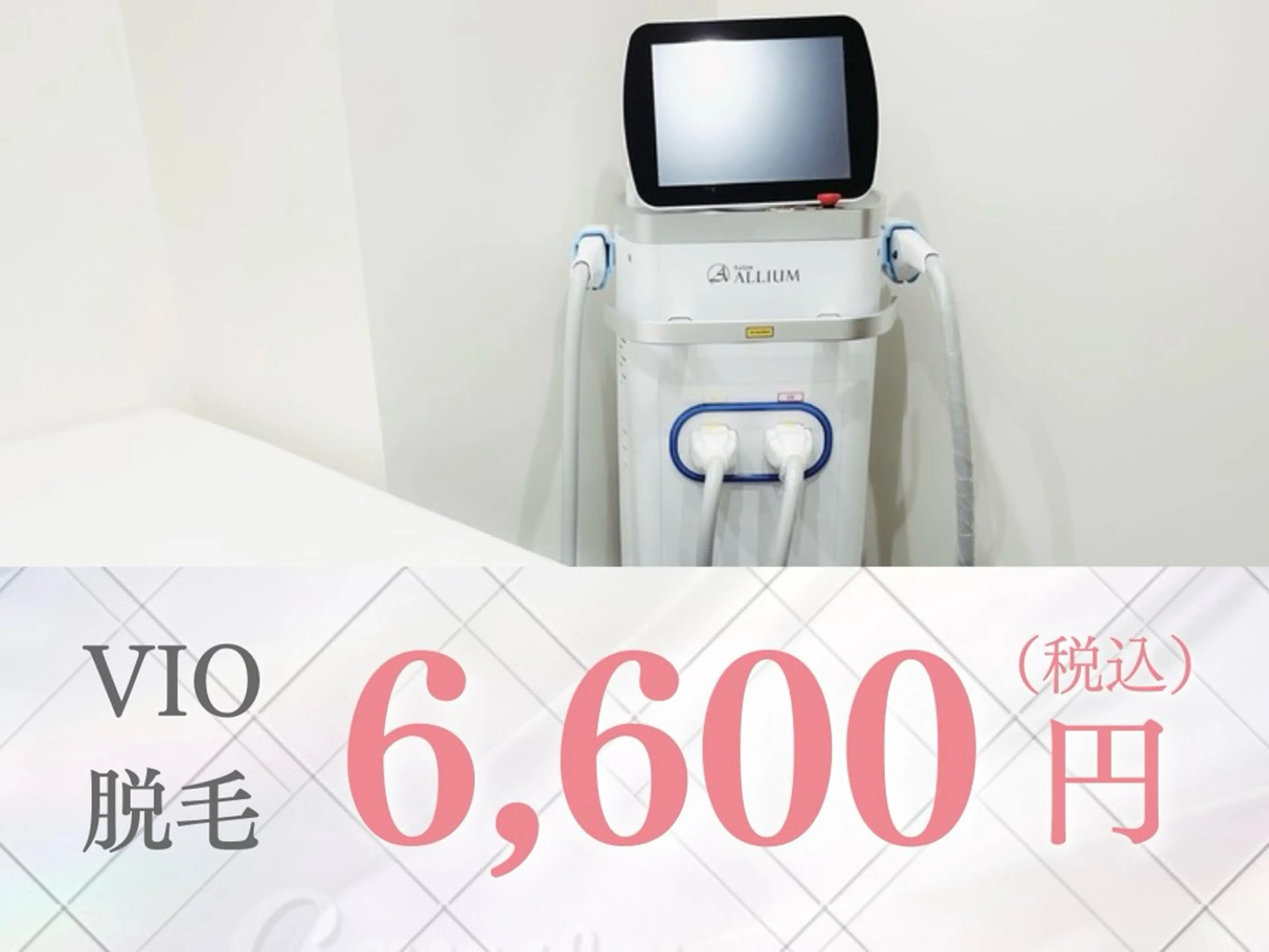 【脱毛】次世代脱毛でツルツル美肌＜最新DPL 式脱毛＞ VIOの写真