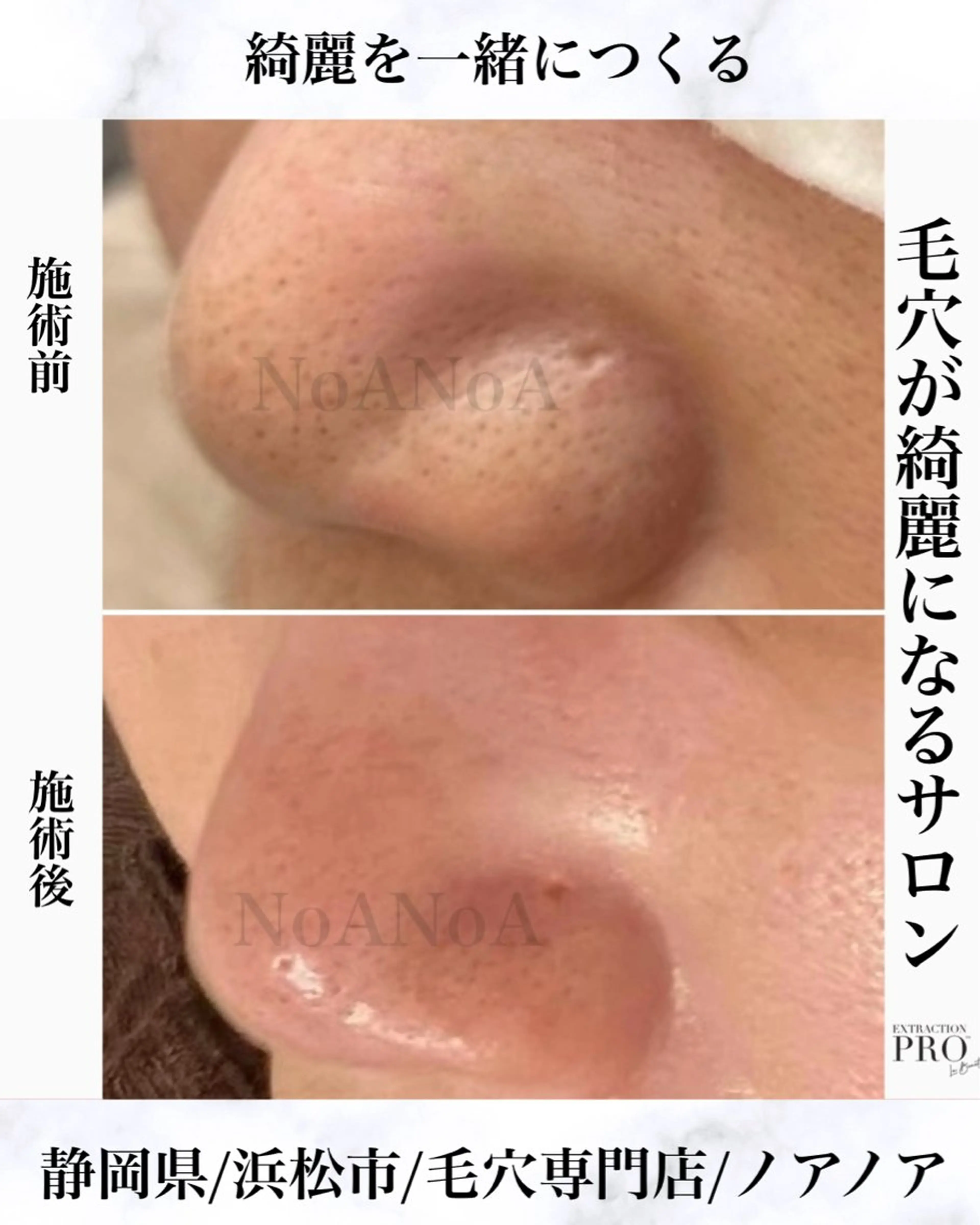 NoANoA Naguraの眉毛・アイブロウイメージ