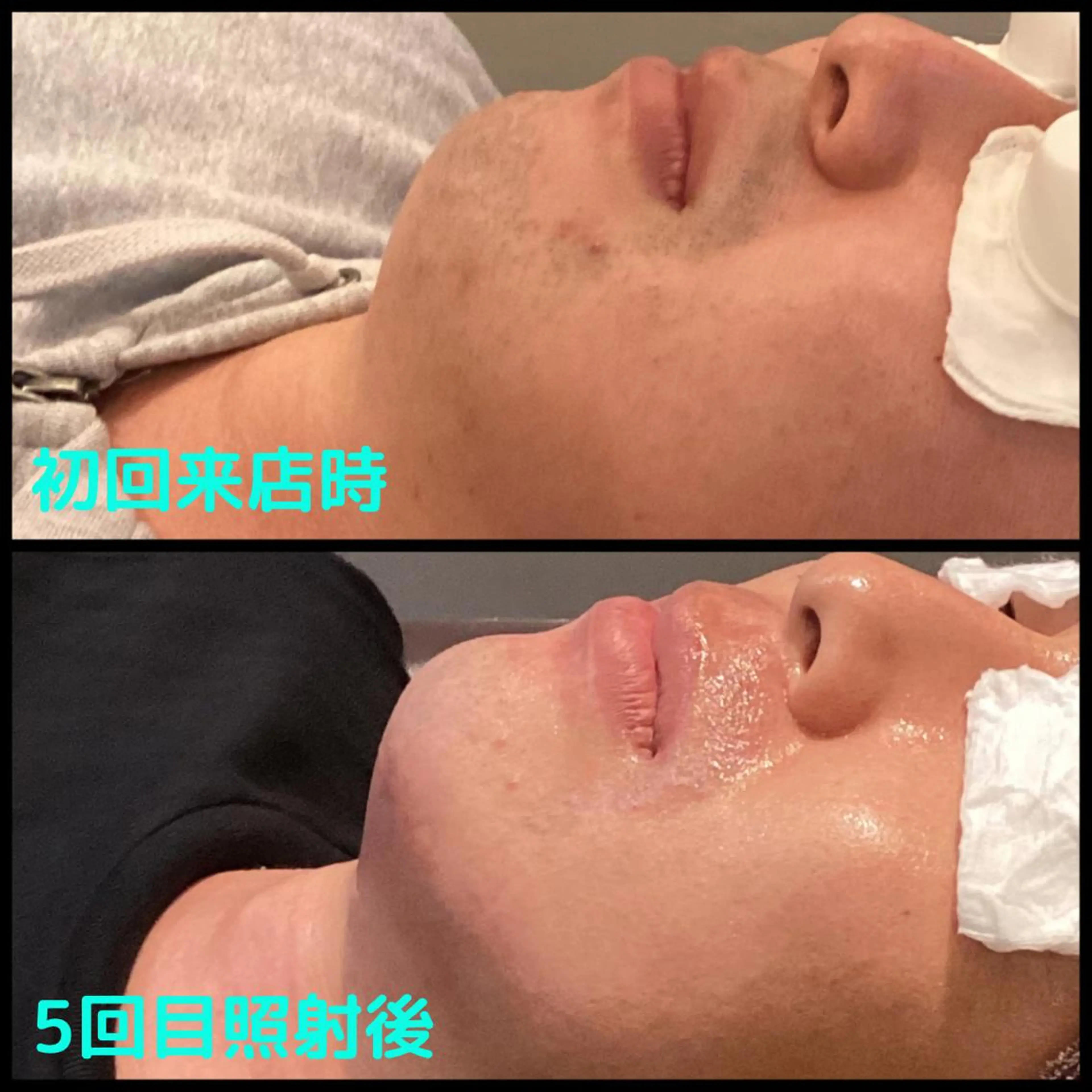 メンズ メンズ脱毛ECXIA所属・men's脱毛サロン ECXIAのエステ・リラクイメージ