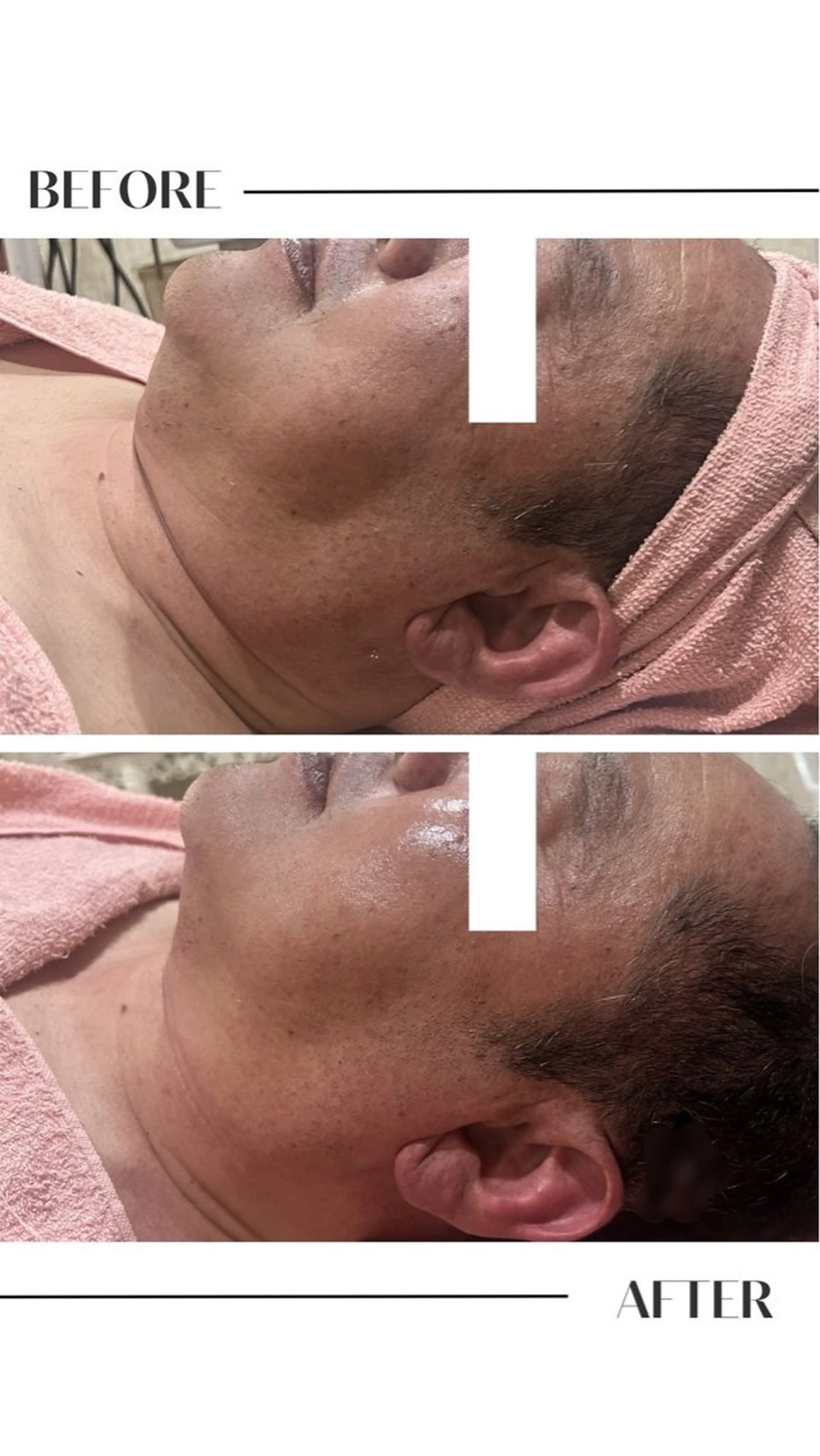 エステ フェイシャル/脱毛 ジョアアンジェ竹田のエステ・リラクイメージ