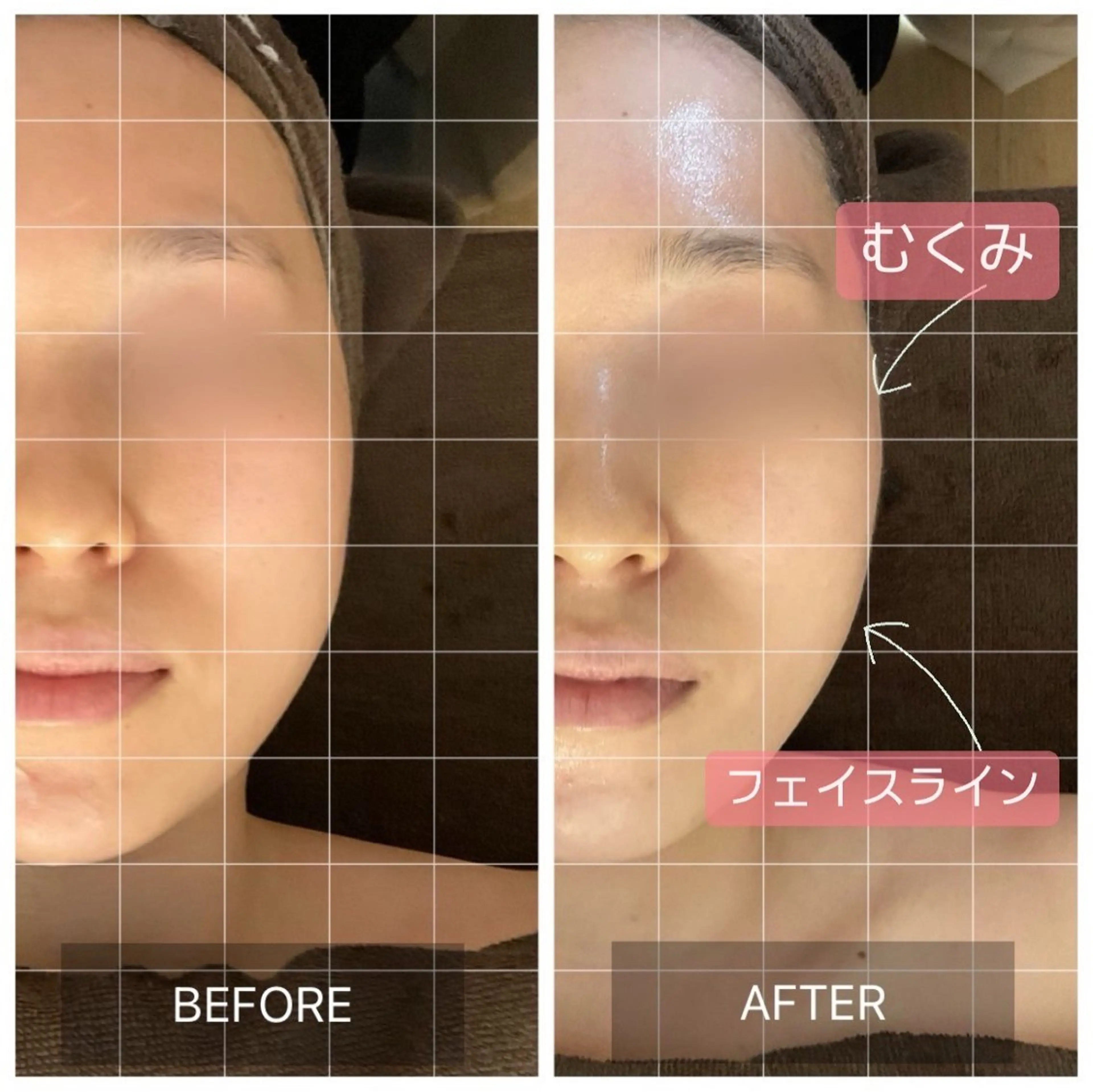 MIRAI小顔 名古屋店のエステ・リラクイメージ