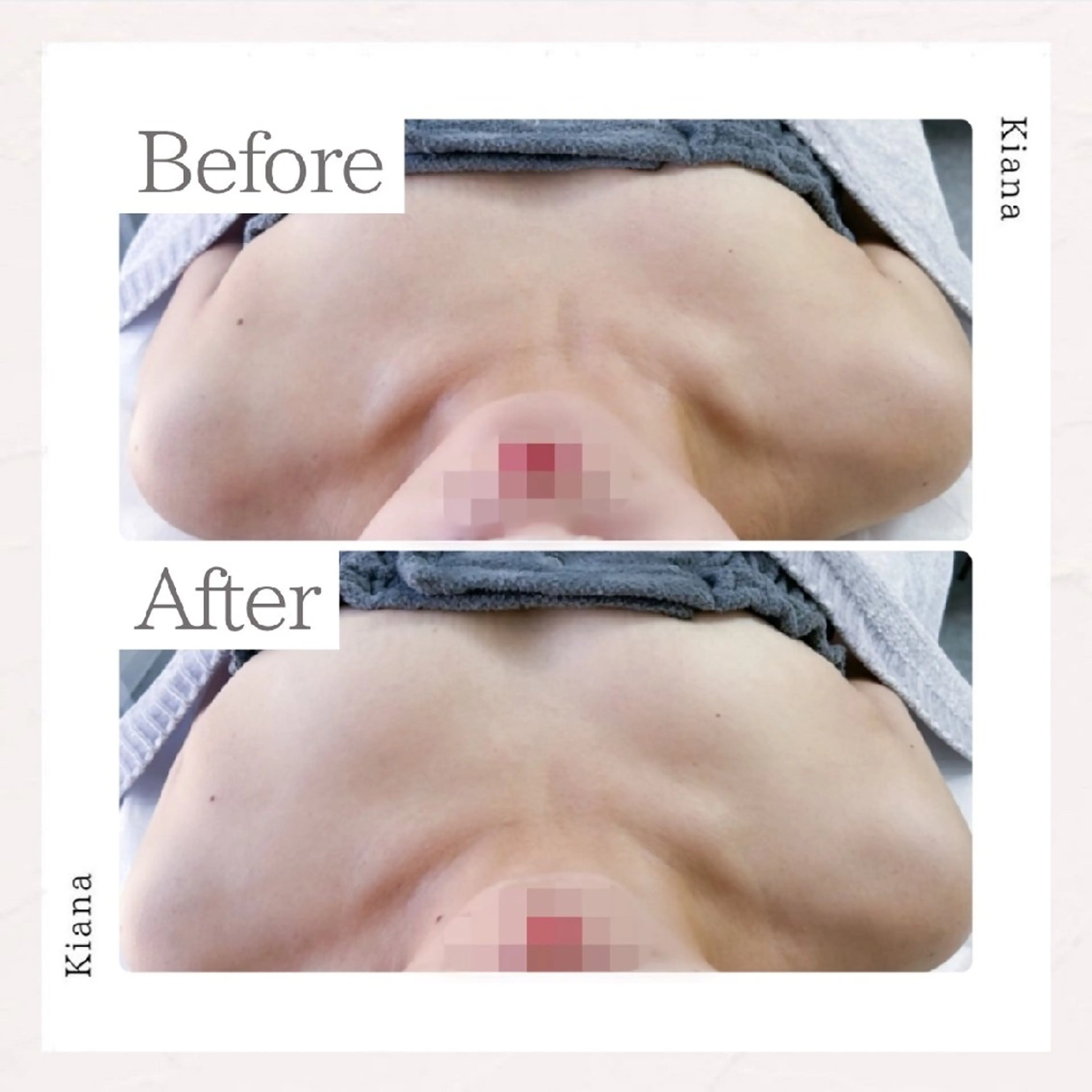 【バスト専門店 】 Kiana のエステ・リラクイメージ